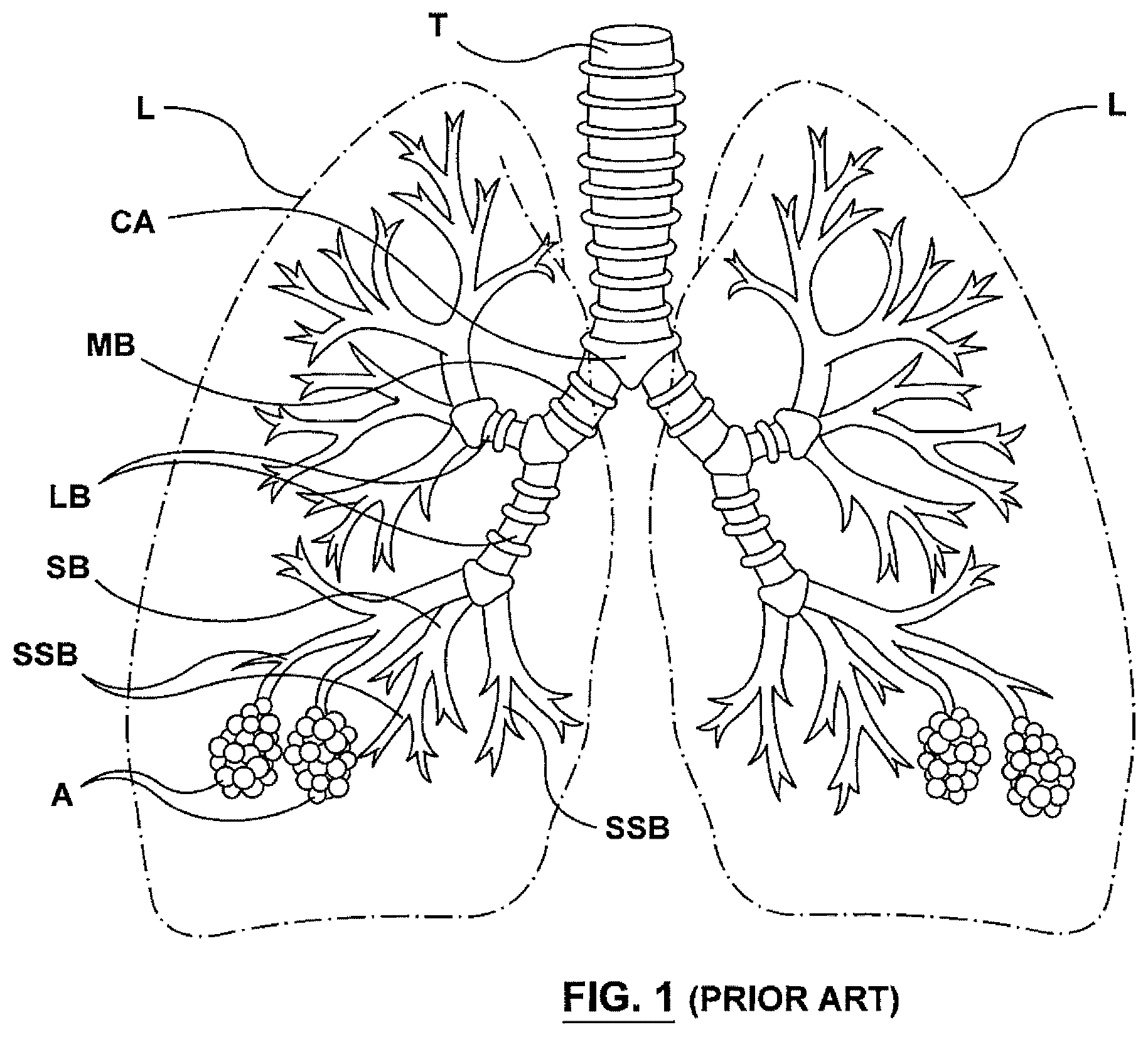 Patent US12403305 Figure 1 – Immunostimulation in the treatment of viral infection