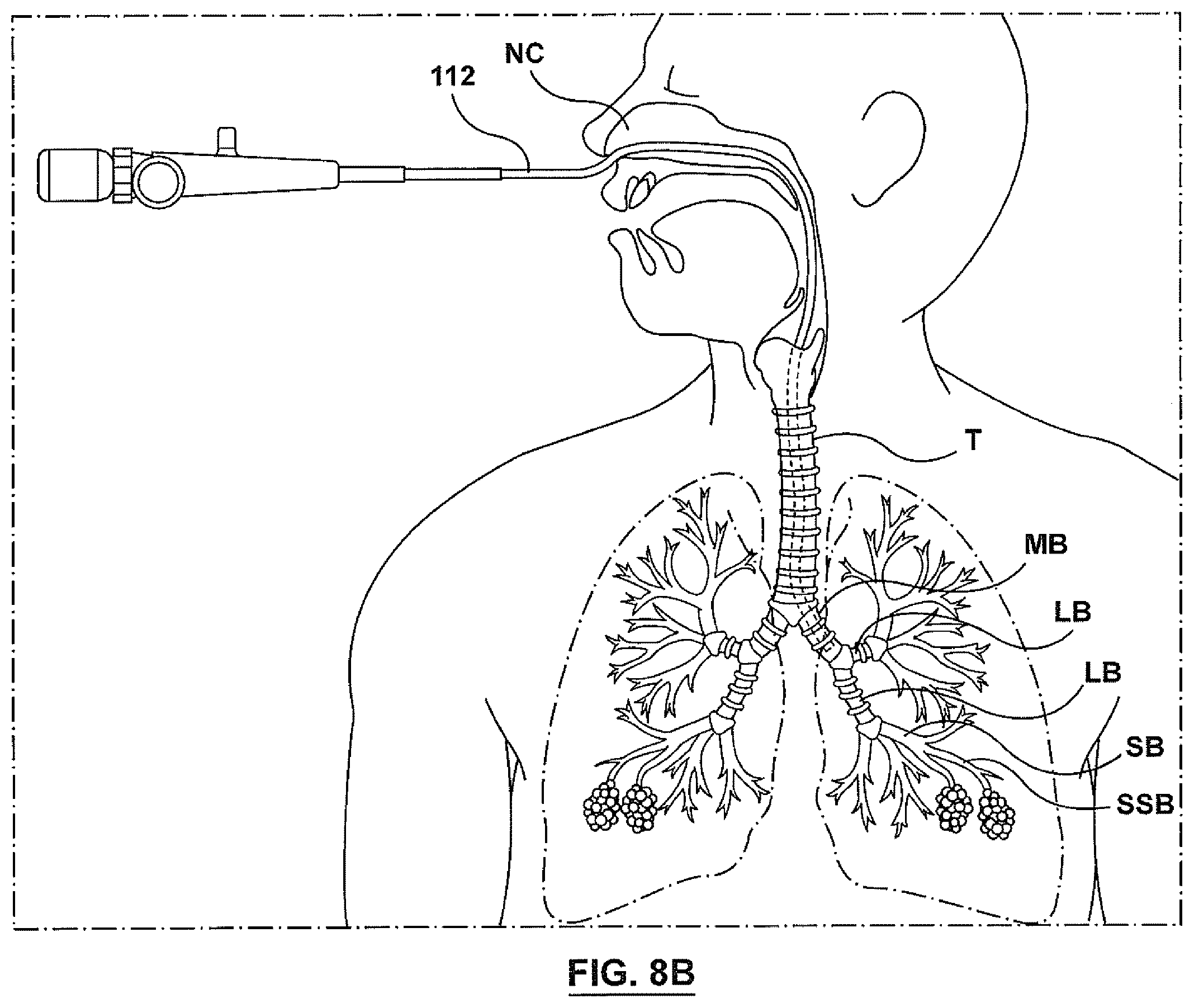 Patent US12403305 Figure 9 – Immunostimulation in the treatment of viral infection