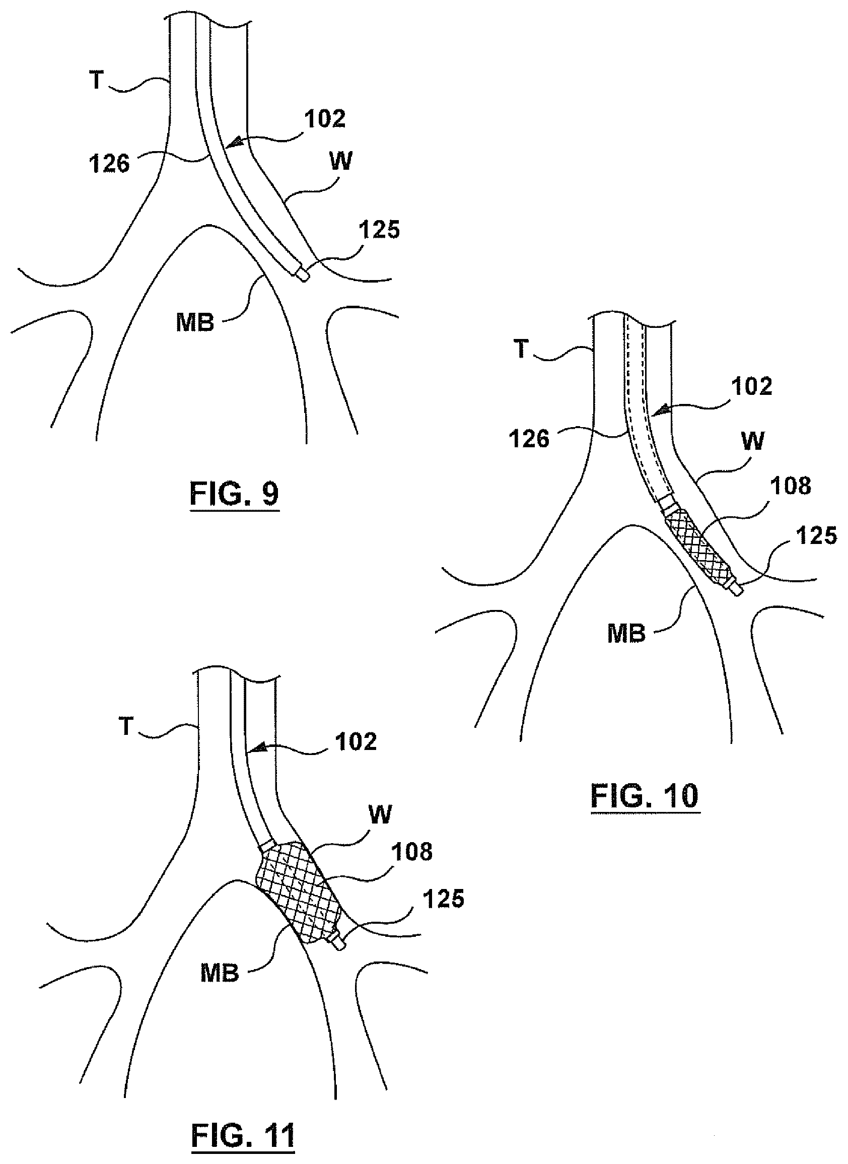 Patent US12403305 Figure 10 – Immunostimulation in the treatment of viral infection