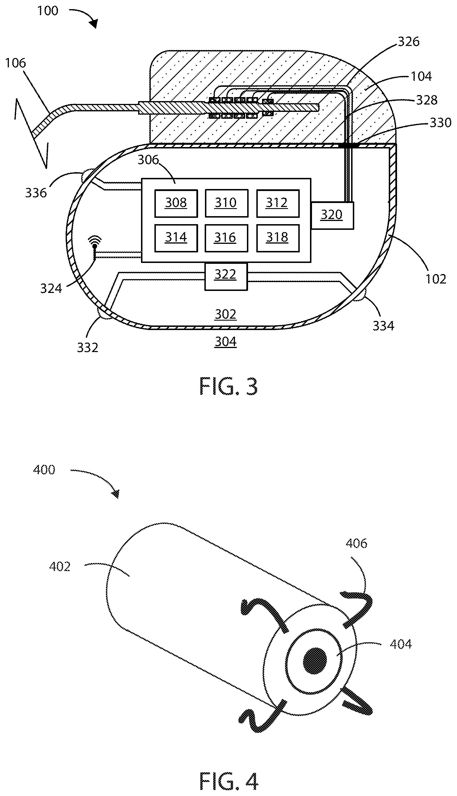 Patent US12403306 Figure 2 – Electric field shaping leads for treatment of cancer