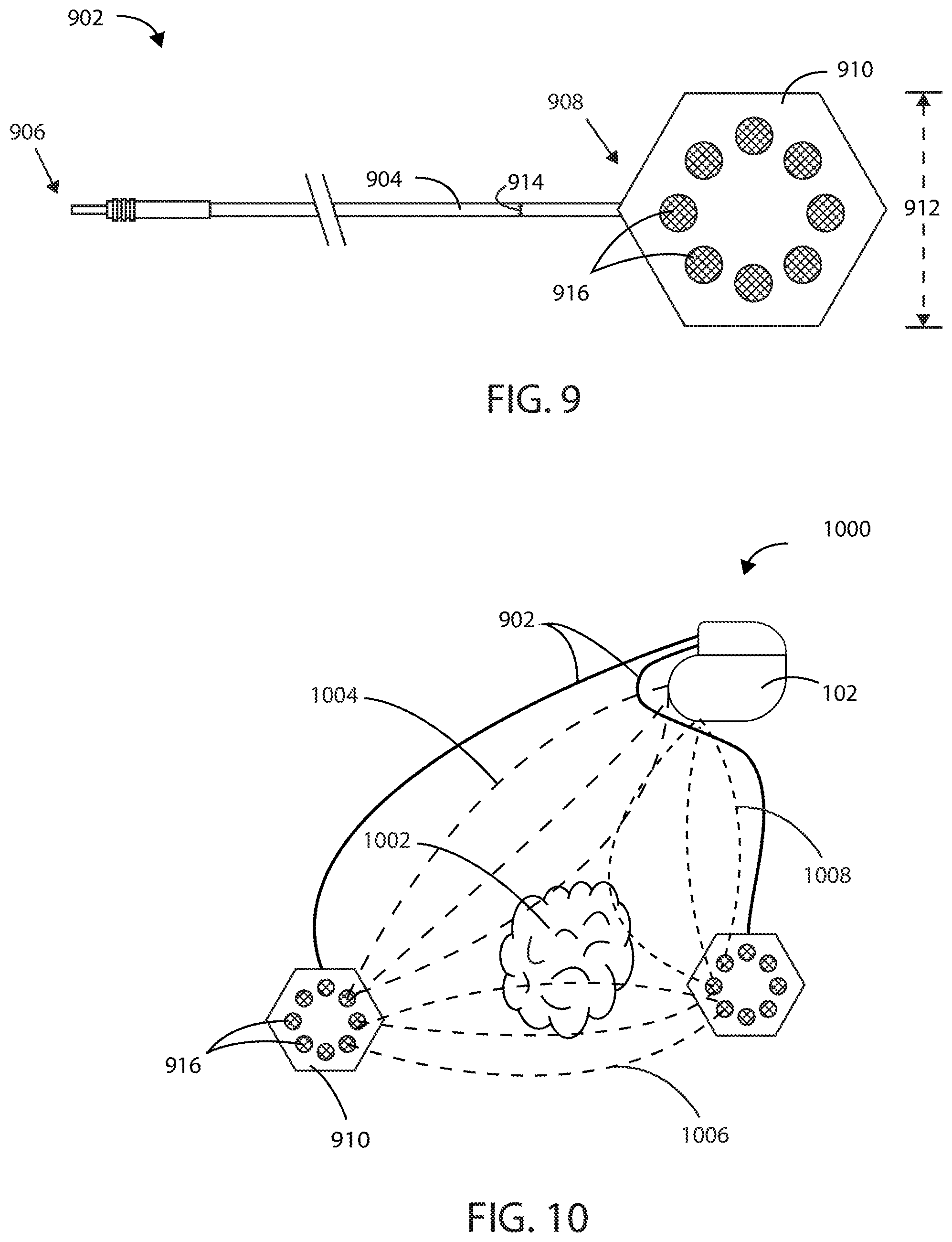 Patent US12403306 Figure 7 – Electric field shaping leads for treatment of cancer