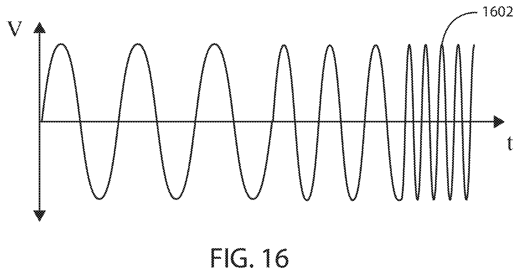 Patent US12403306 Figure 11 – Electric field shaping leads for treatment of cancer