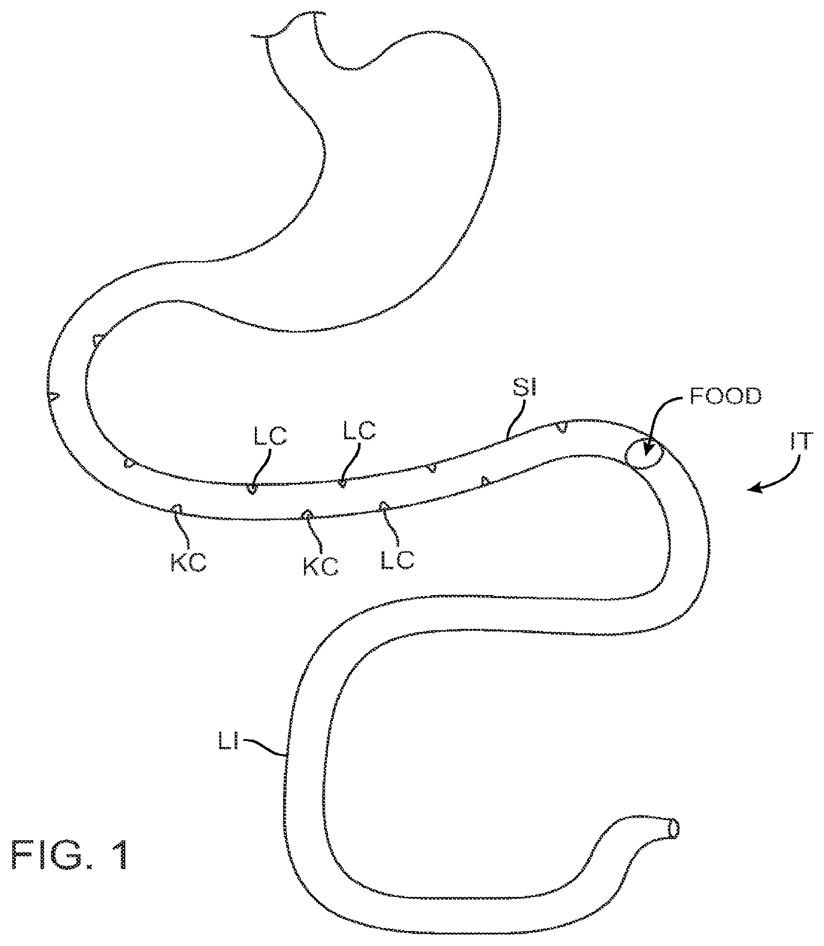 Patent US12403308 Figure 1 – Swallowable capsule and method for stimulating incretin production within the intestinal tract