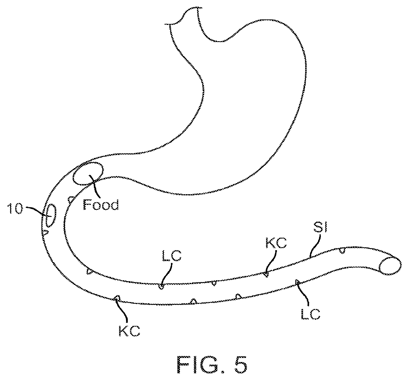 Patent US12403308 Figure 5 – Swallowable capsule and method for stimulating incretin production within the intestinal tract