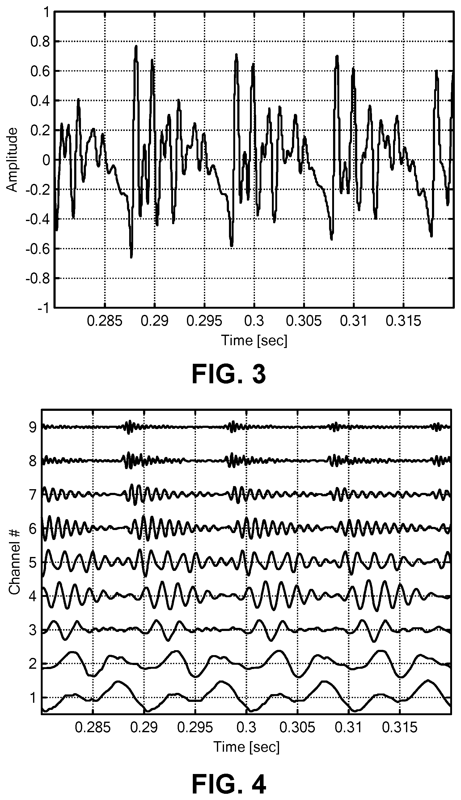 Patent US12403310 Figure 3 – Medial olivocochlear reflex sound coding with bandwidth normalization