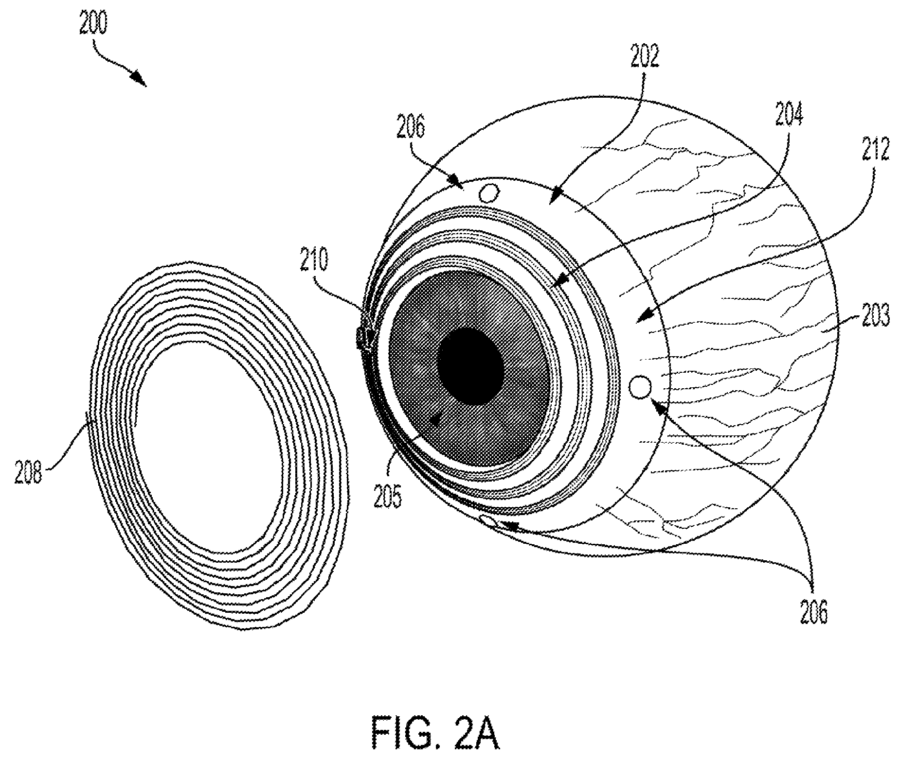 Patent US12403311 Figure 2 – System and method to induce epigenetic changes to the cells and tissue of the eye and orbit