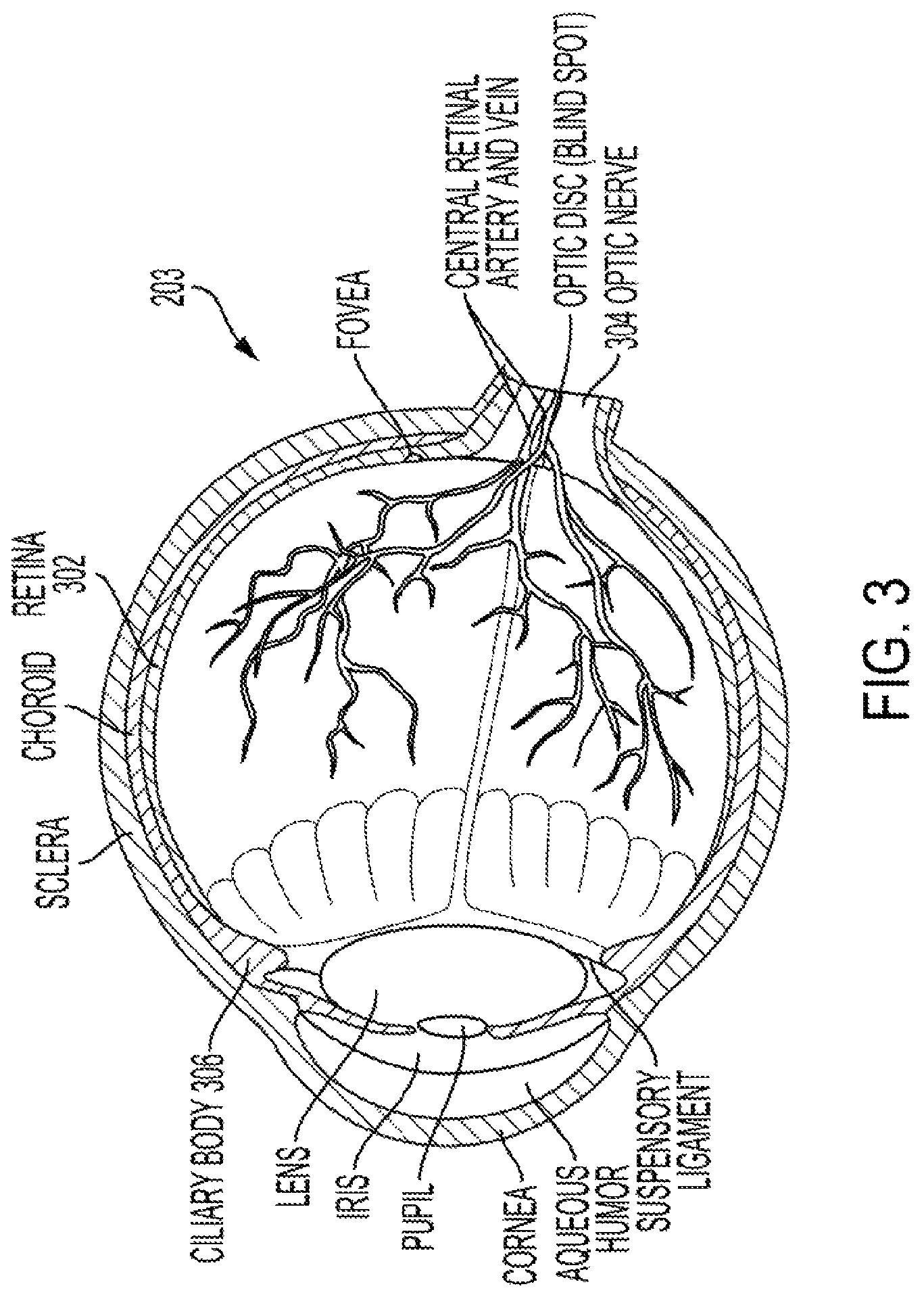 Patent US12403311 Figure 5 – System and method to induce epigenetic changes to the cells and tissue of the eye and orbit