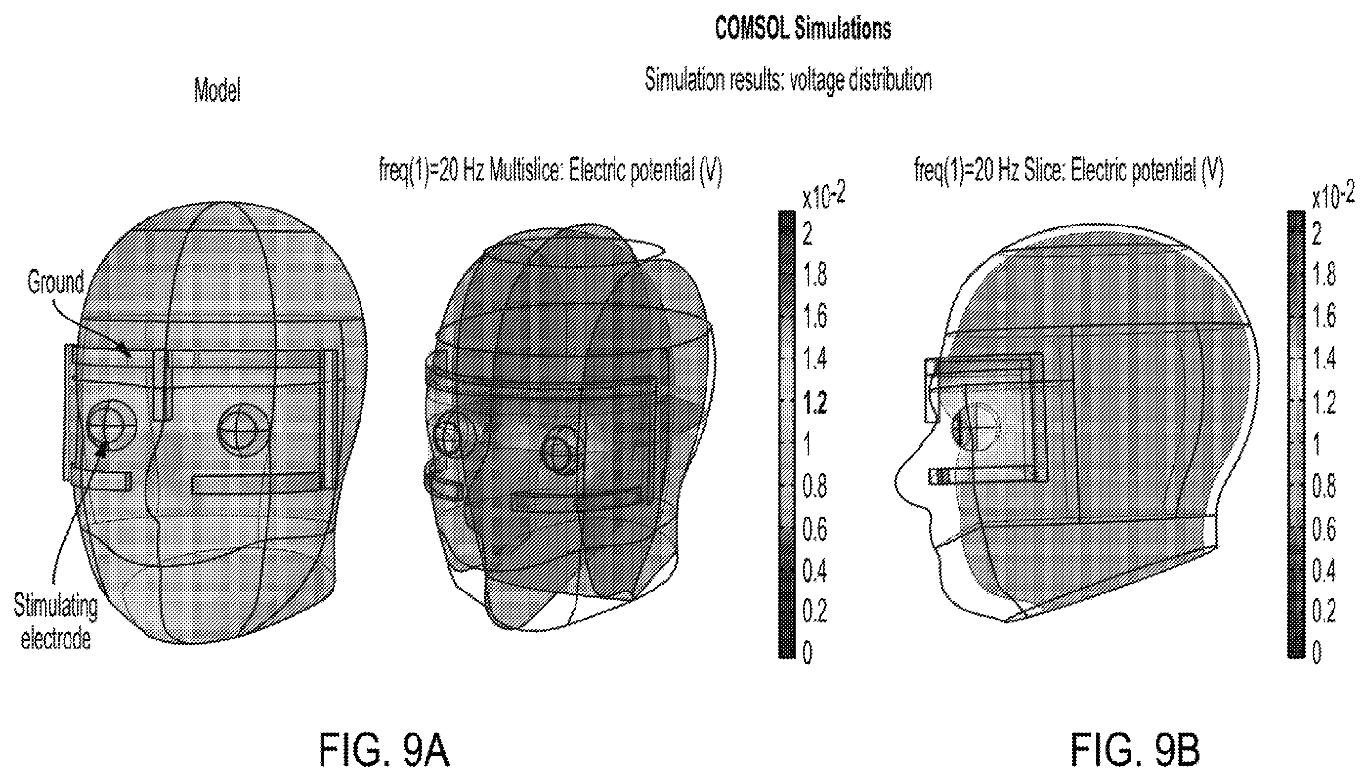 Patent US12403311 Figure 17 – System and method to induce epigenetic changes to the cells and tissue of the eye and orbit