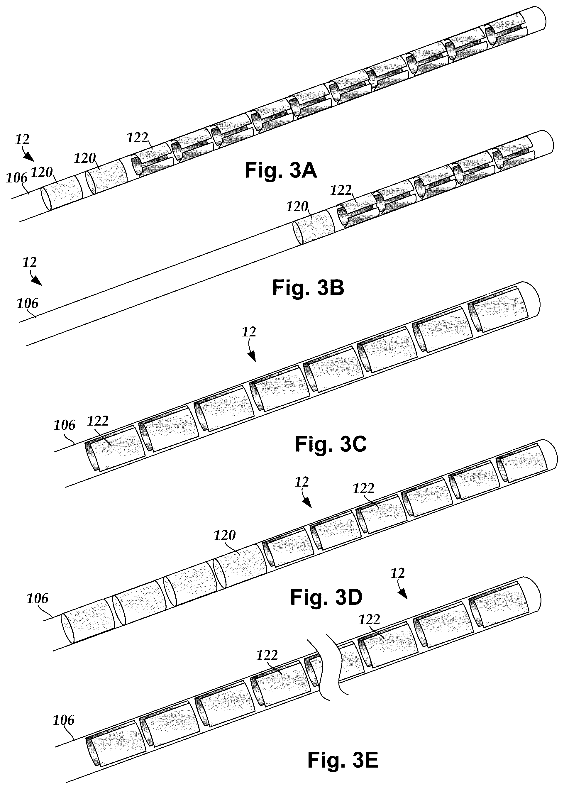 Patent US12403315 Figure 3 – Systems and methods for automated programming of electrical stimulation