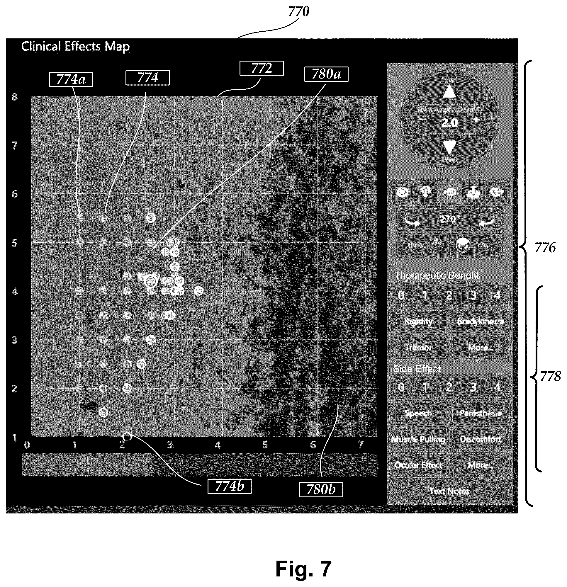 Patent US12403315 Figure 6 – Systems and methods for automated programming of electrical stimulation