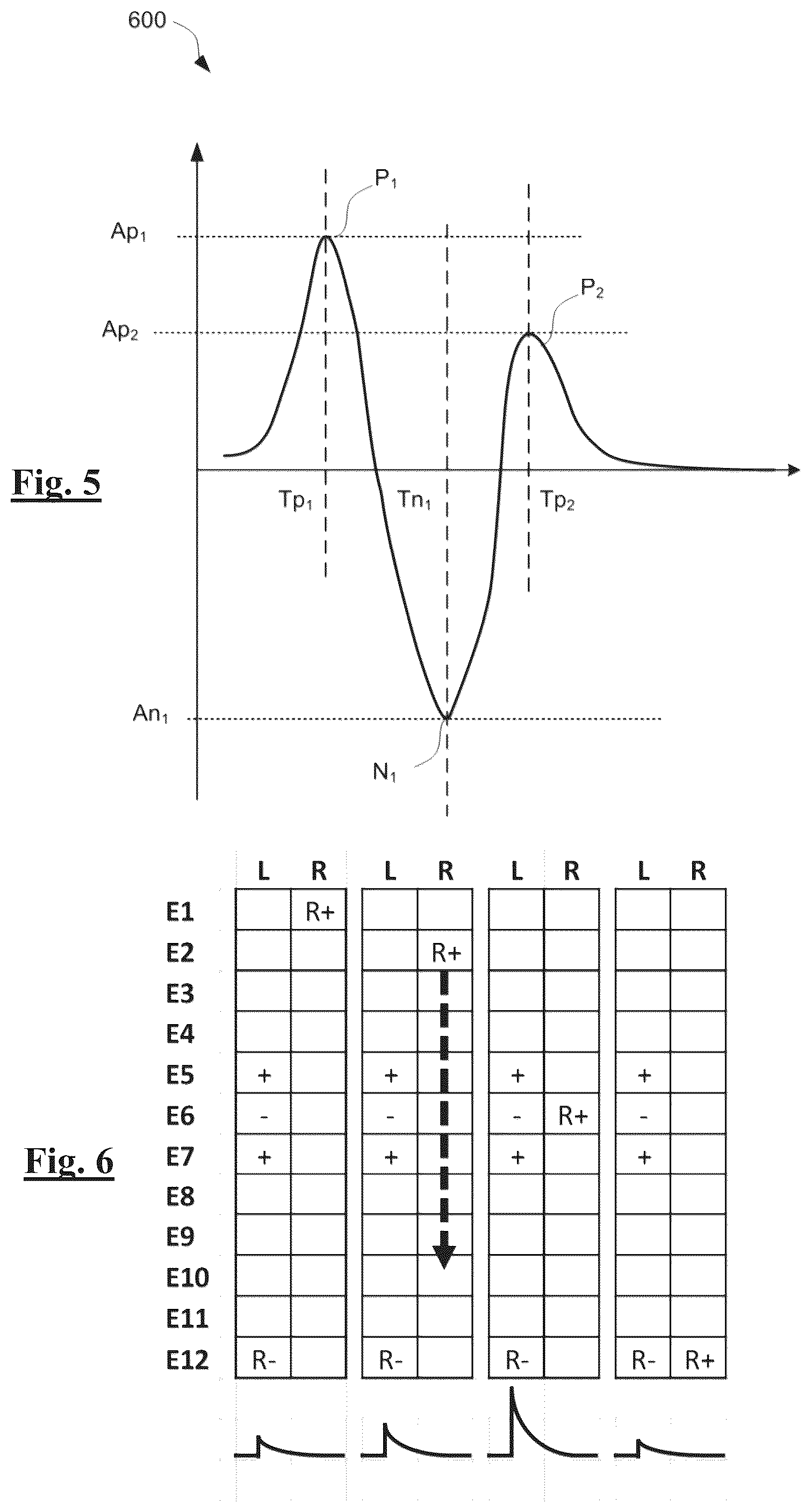 Patent US12403317 Figure 3 – Programming of neuromodulation therapy