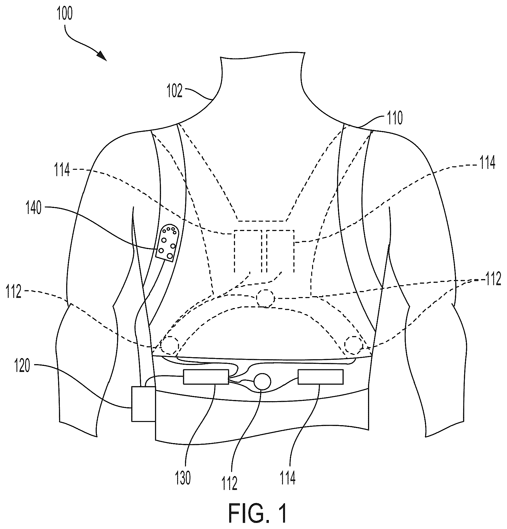 Patent US12403322 Figure 1 – Modular ingress protected electrode system for a wearable defibrillator