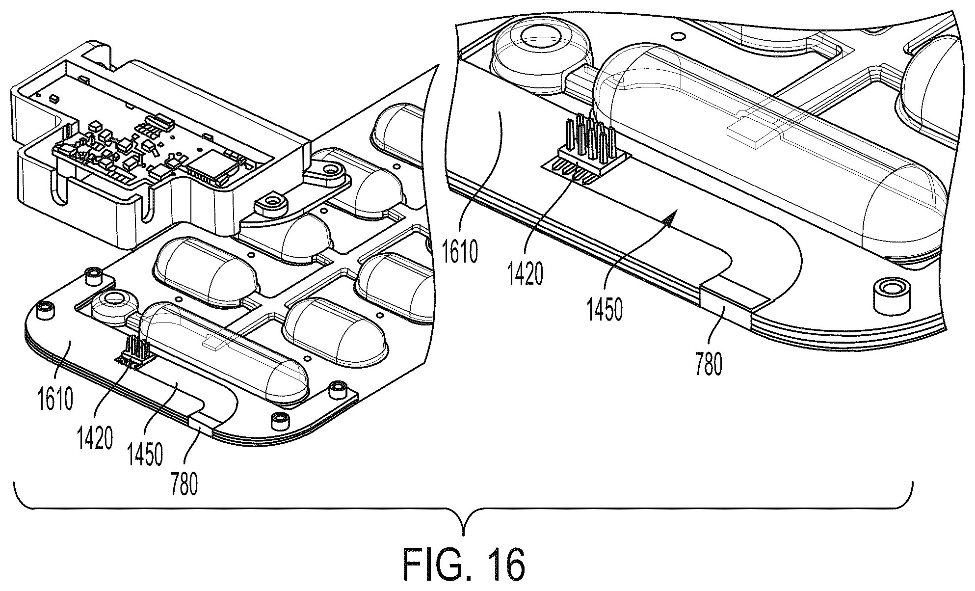 Patent US12403322 Figure 18 – Modular ingress protected electrode system for a wearable defibrillator