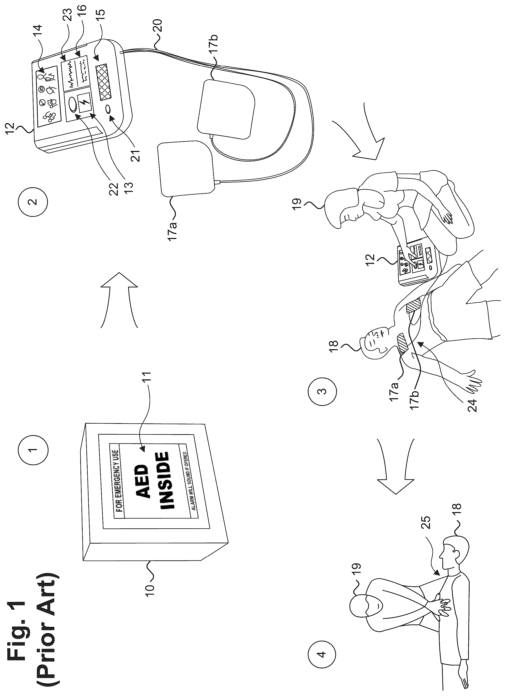 Patent US12403323 Figure 1 – Defibrillation assembly energizable through case opening