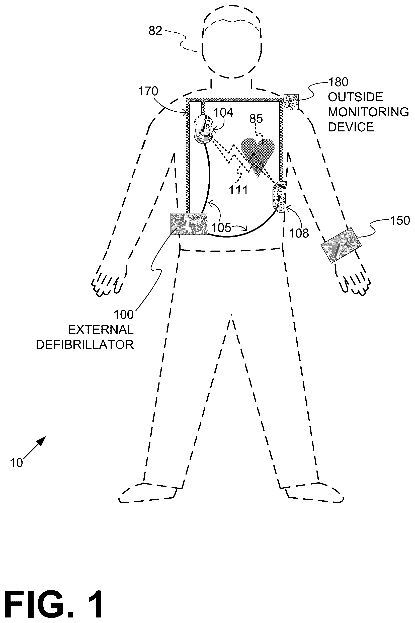 Patent US12403324 Figure 1 – Wearable medical device (WMD) implementing adaptive techniques to save power