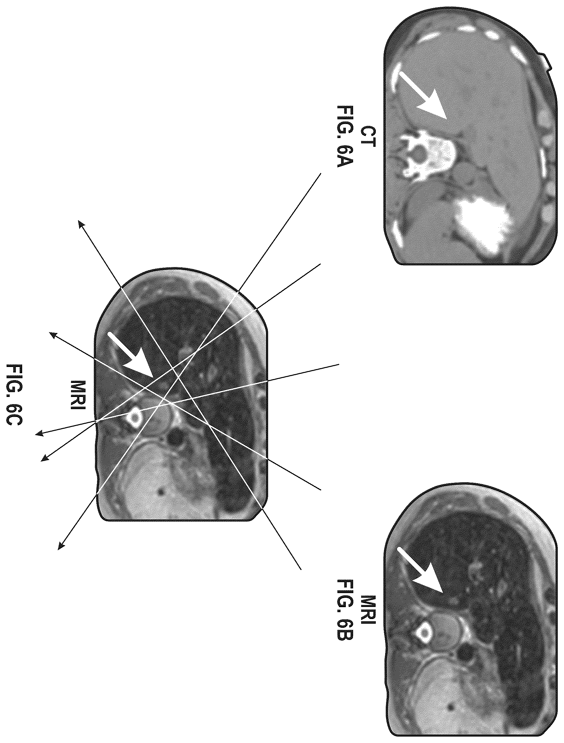 Patent US12403329 Figure 6 – Updating proton stopping power maps for proton radiation therapy treatment planning