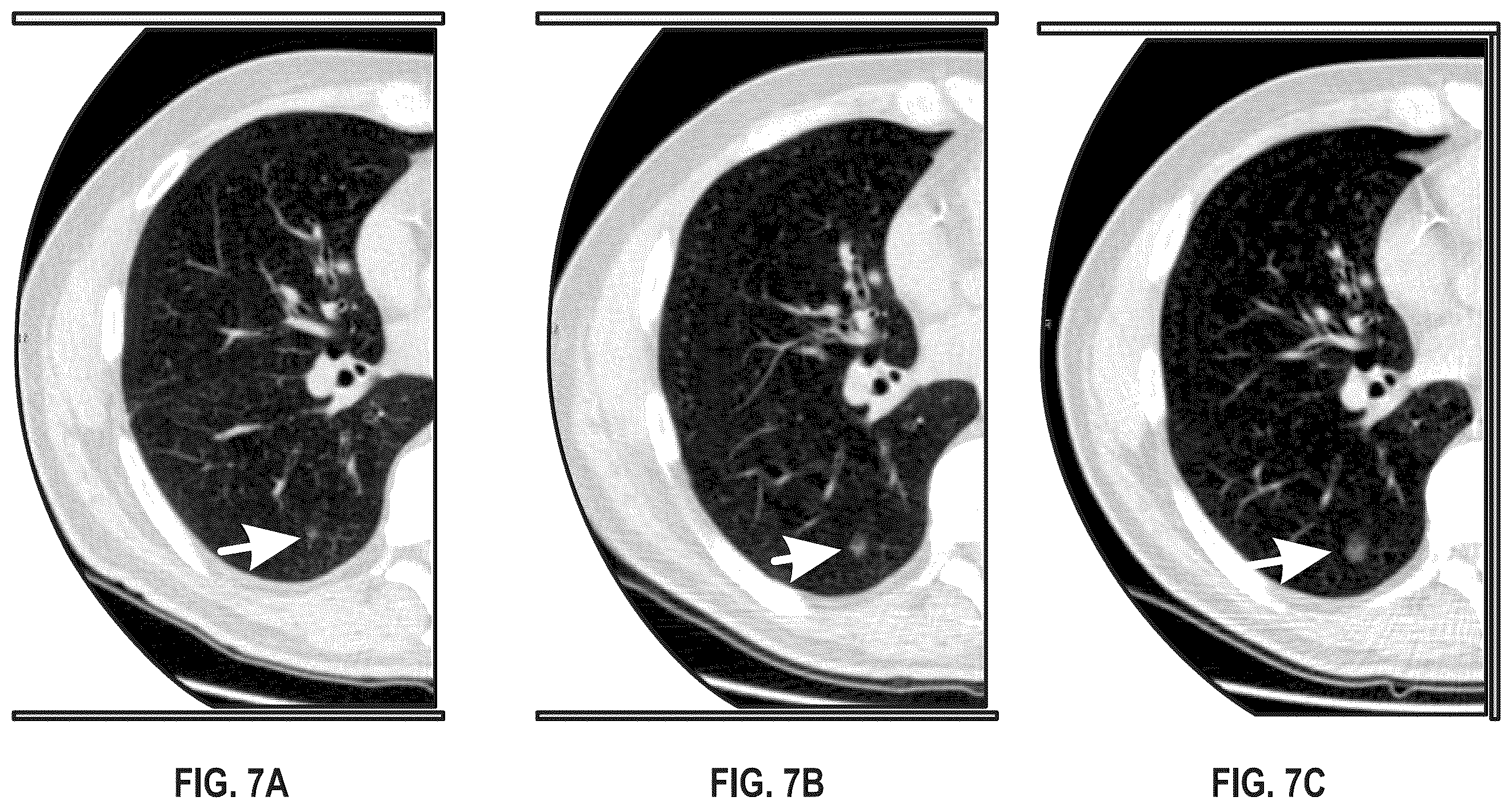 Patent US12403329 Figure 7 – Updating proton stopping power maps for proton radiation therapy treatment planning