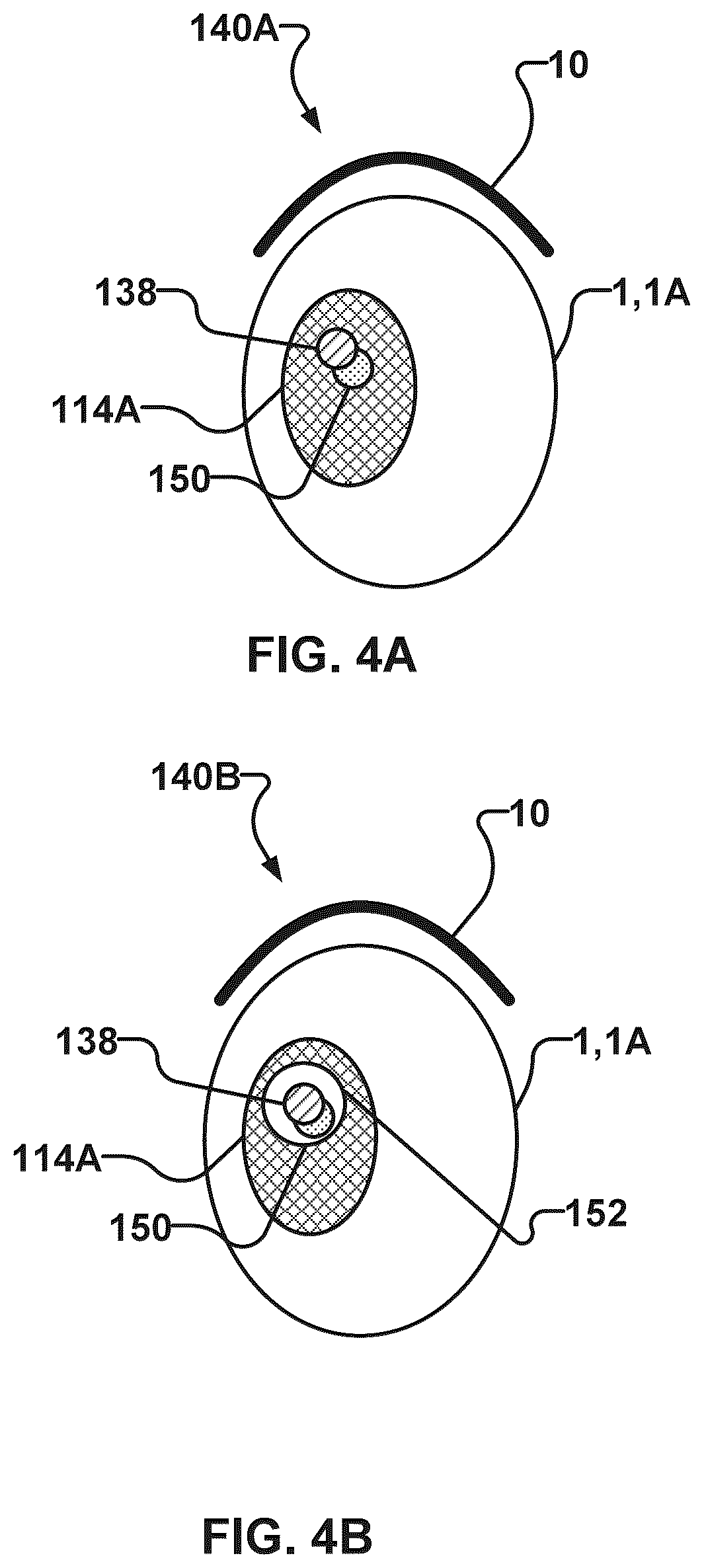 Patent US12403333 Figure 4 – Methods and systems for confirming focus of ultrasound beams