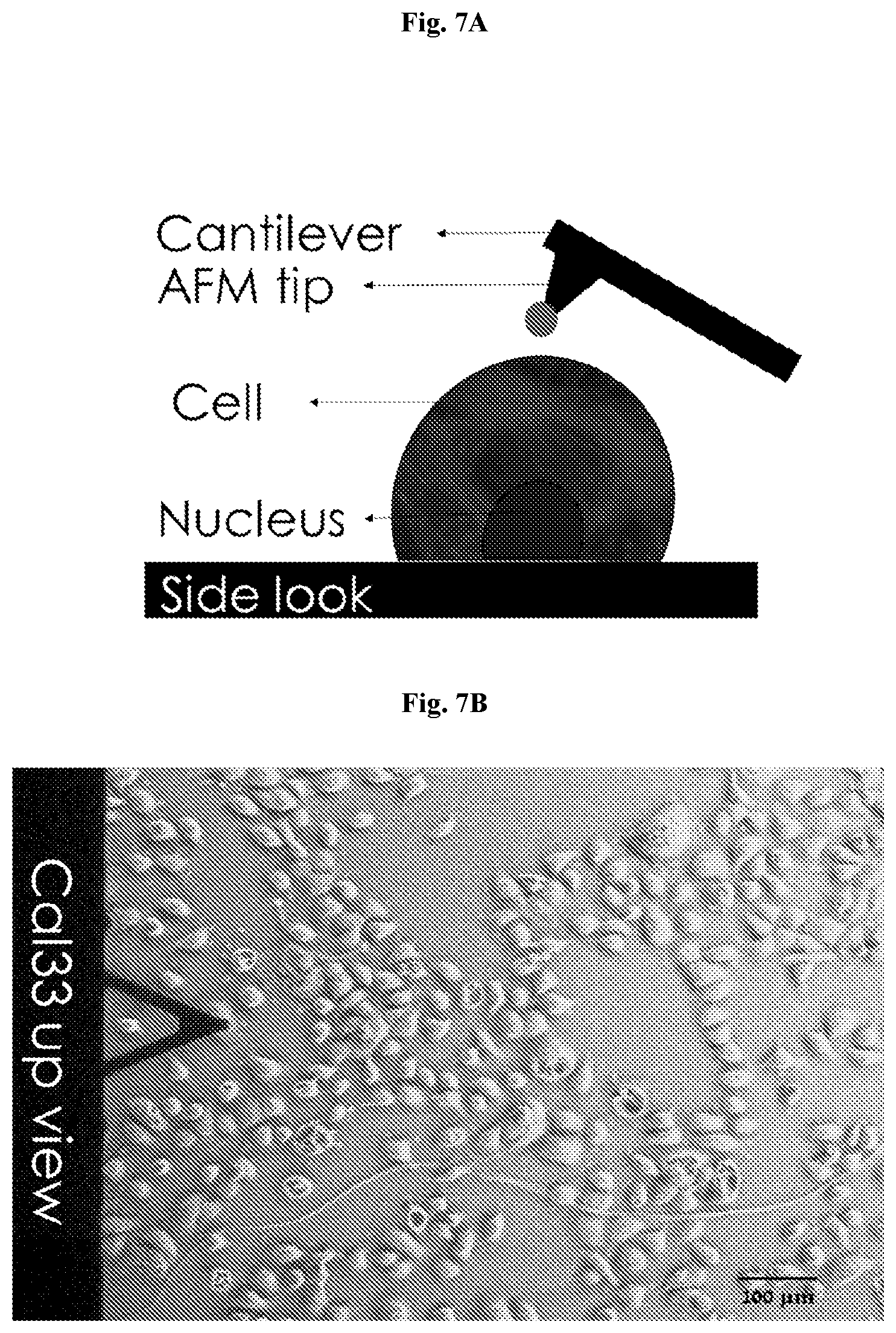 Patent US12403334 Figure 5 – Low intensity ultrasound therapy