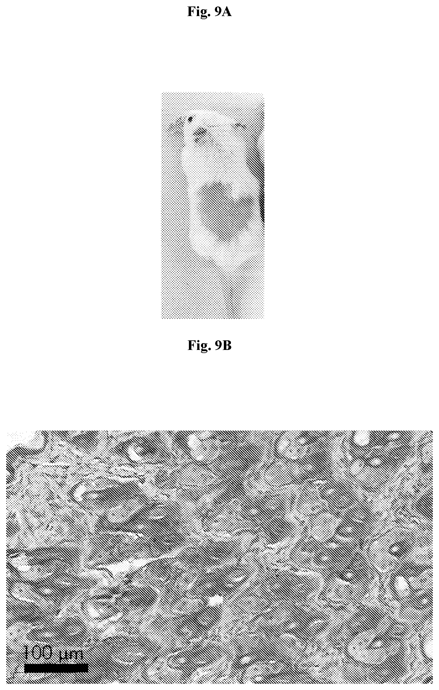 Patent US12403334 Figure 12 – Low intensity ultrasound therapy
