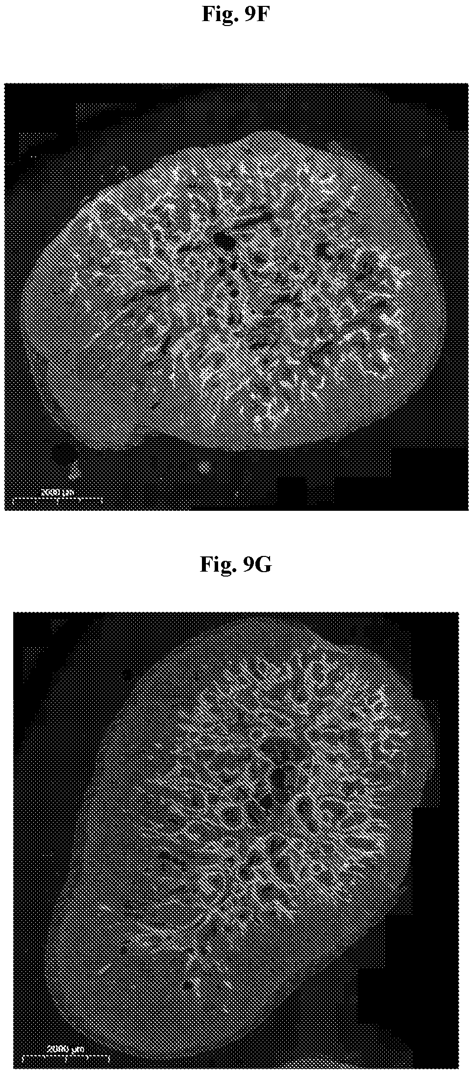 Patent US12403334 Figure 16 – Low intensity ultrasound therapy