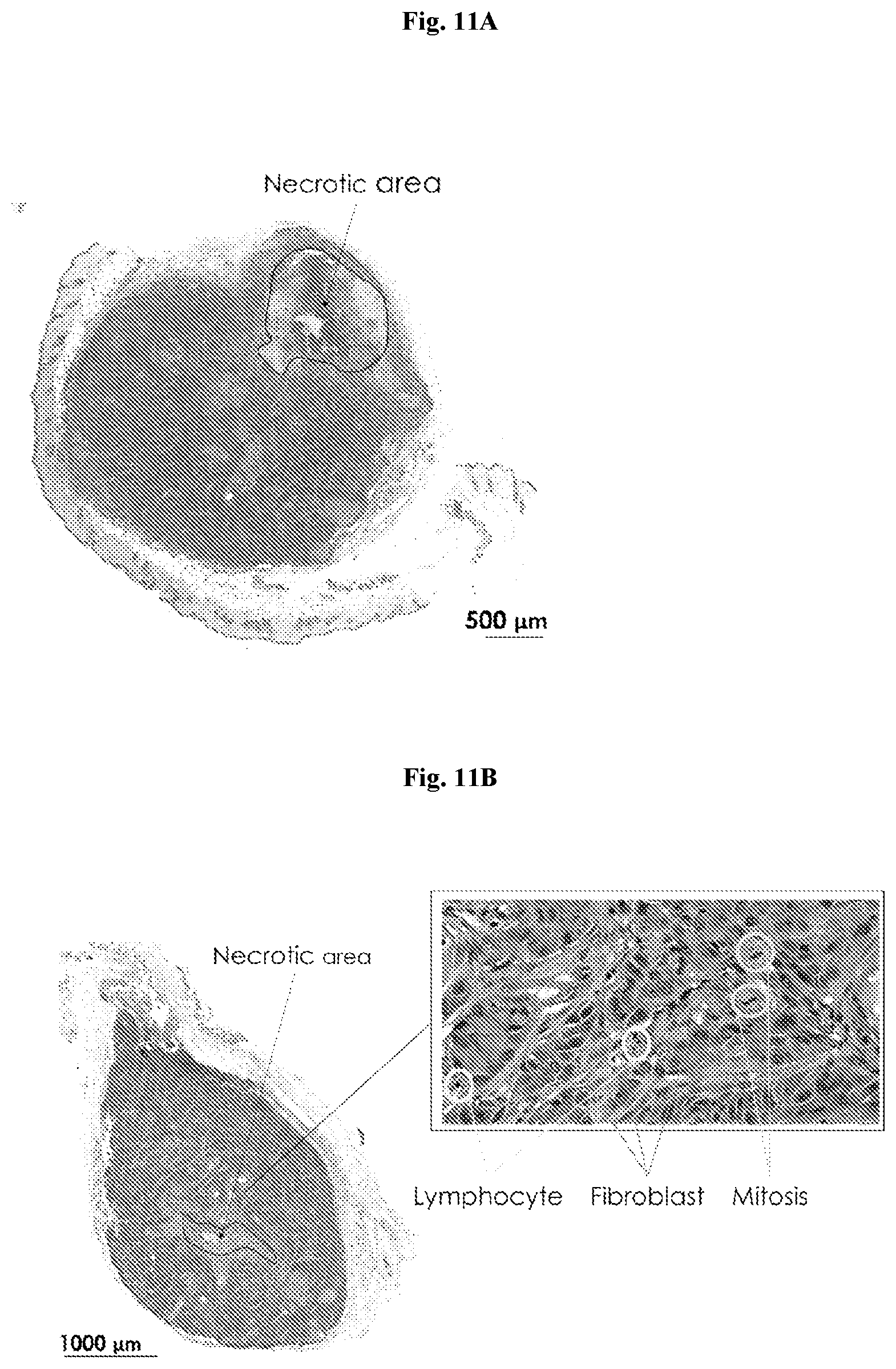 Patent US12403334 Figure 20 – Low intensity ultrasound therapy