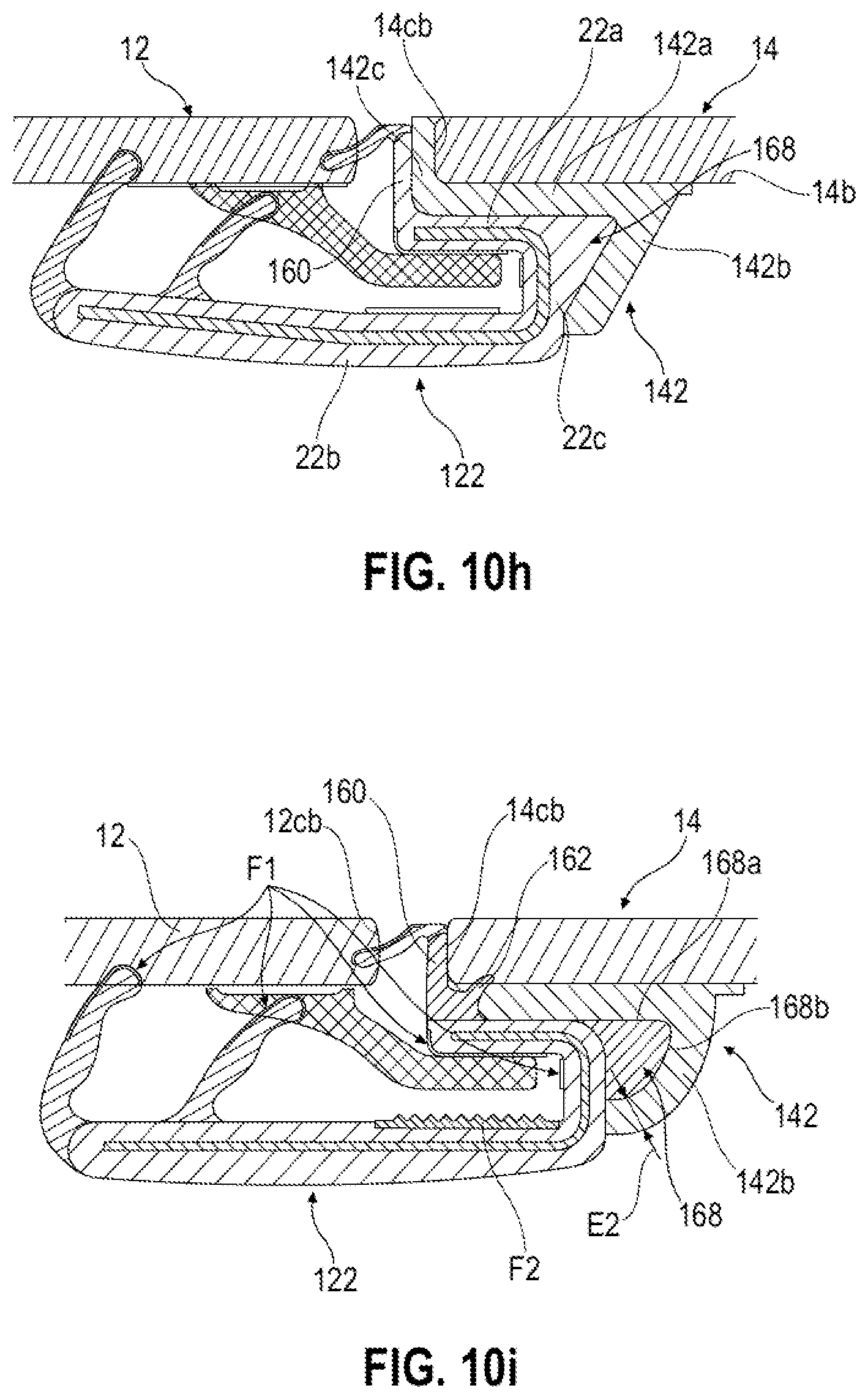 Patent US12403755 Figure 9 – Encapsulated fixed window module for a motor vehicle