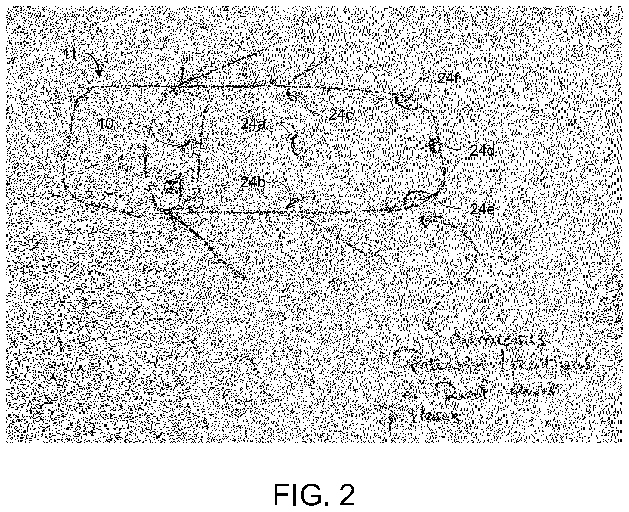 Patent US12403834 Figure 2 – Vehicular driver monitoring system with camera at interior mirror assembly