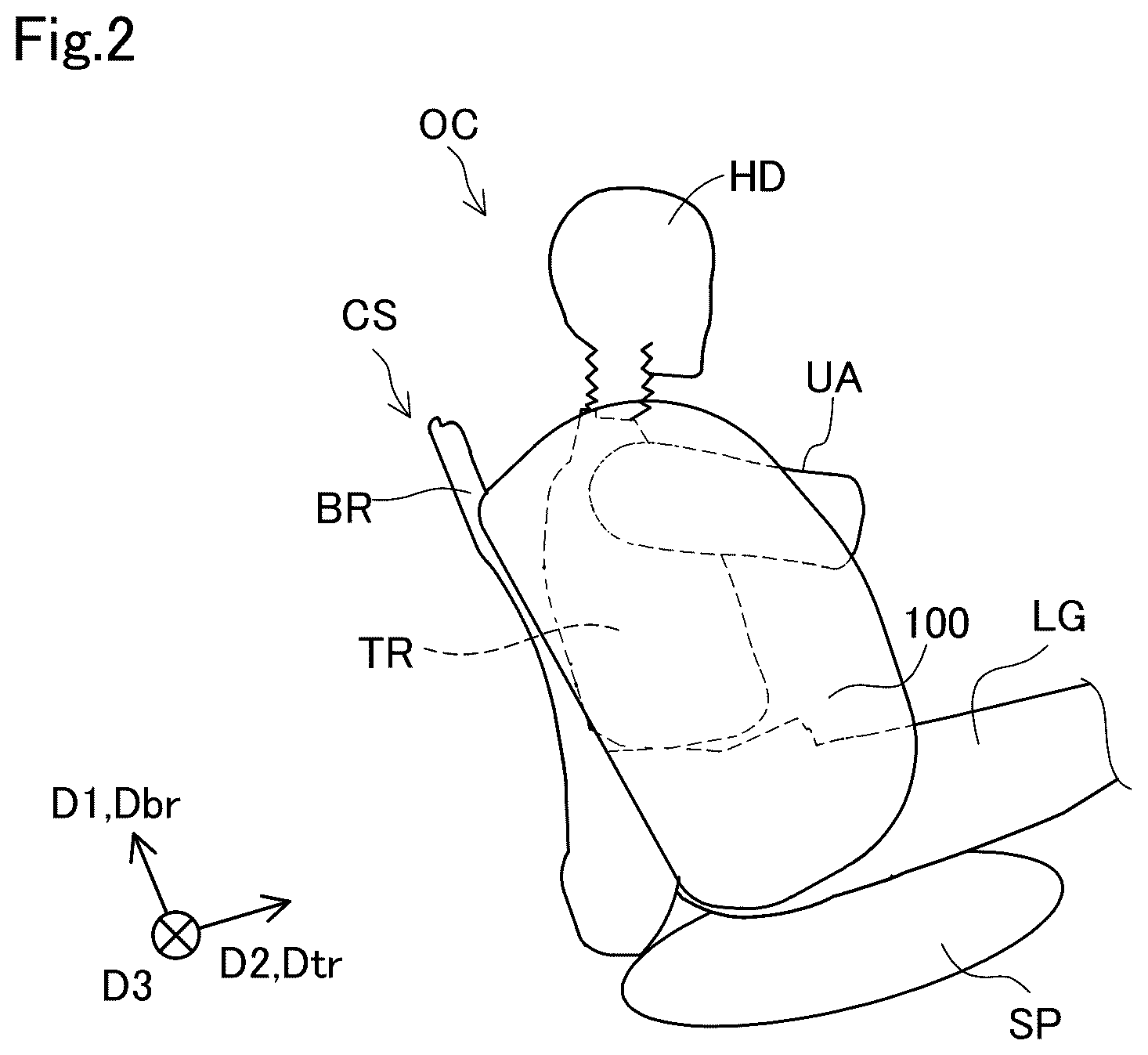 Patent US12403859 Figure 2 – Side airbag device and airbag folding method