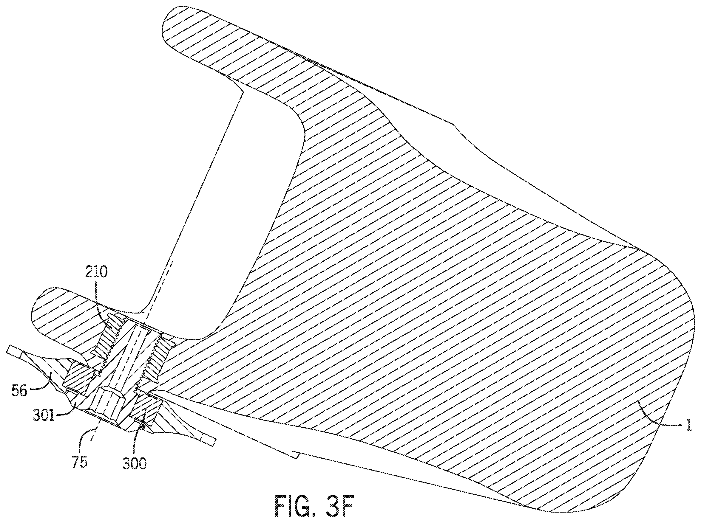 Patent US12403979 Figure 19 – 6-bar vehicle suspension linkage with drive train idler