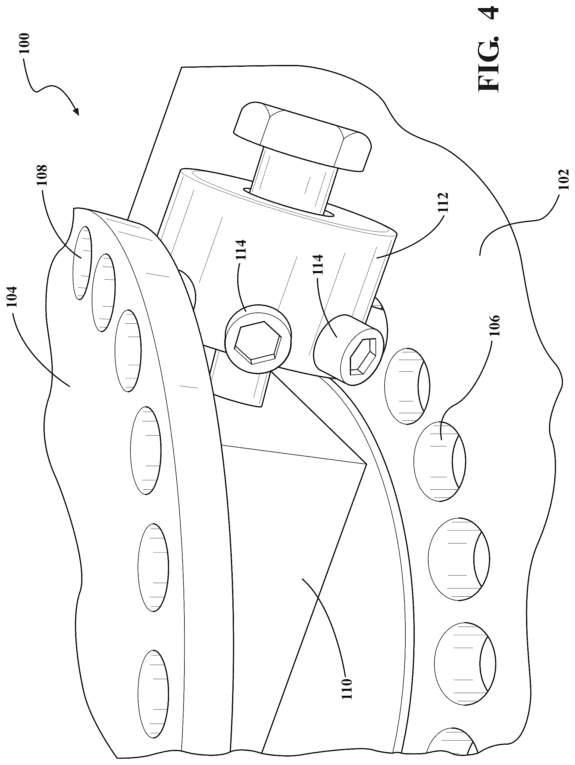 Patent US12403984 Figure 4 – Rotating drivetrain assembly for vehicles