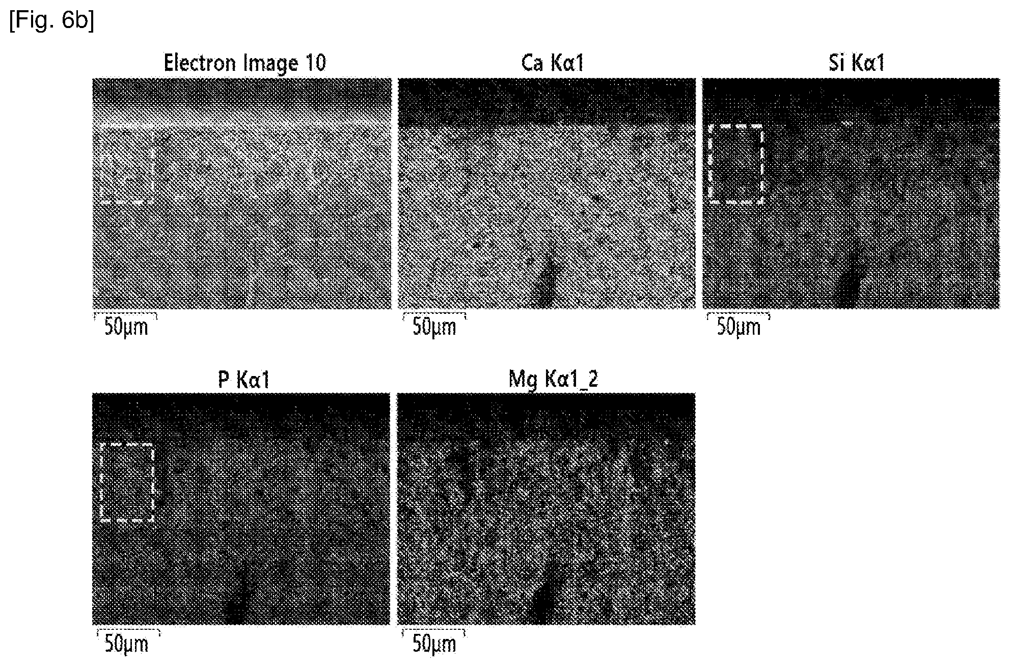 Patent US12410091 Figure 5 – Bioactive crystallized glass ceramic comprising wollastonite, hydroxyapatite and diopside, and use thereof
