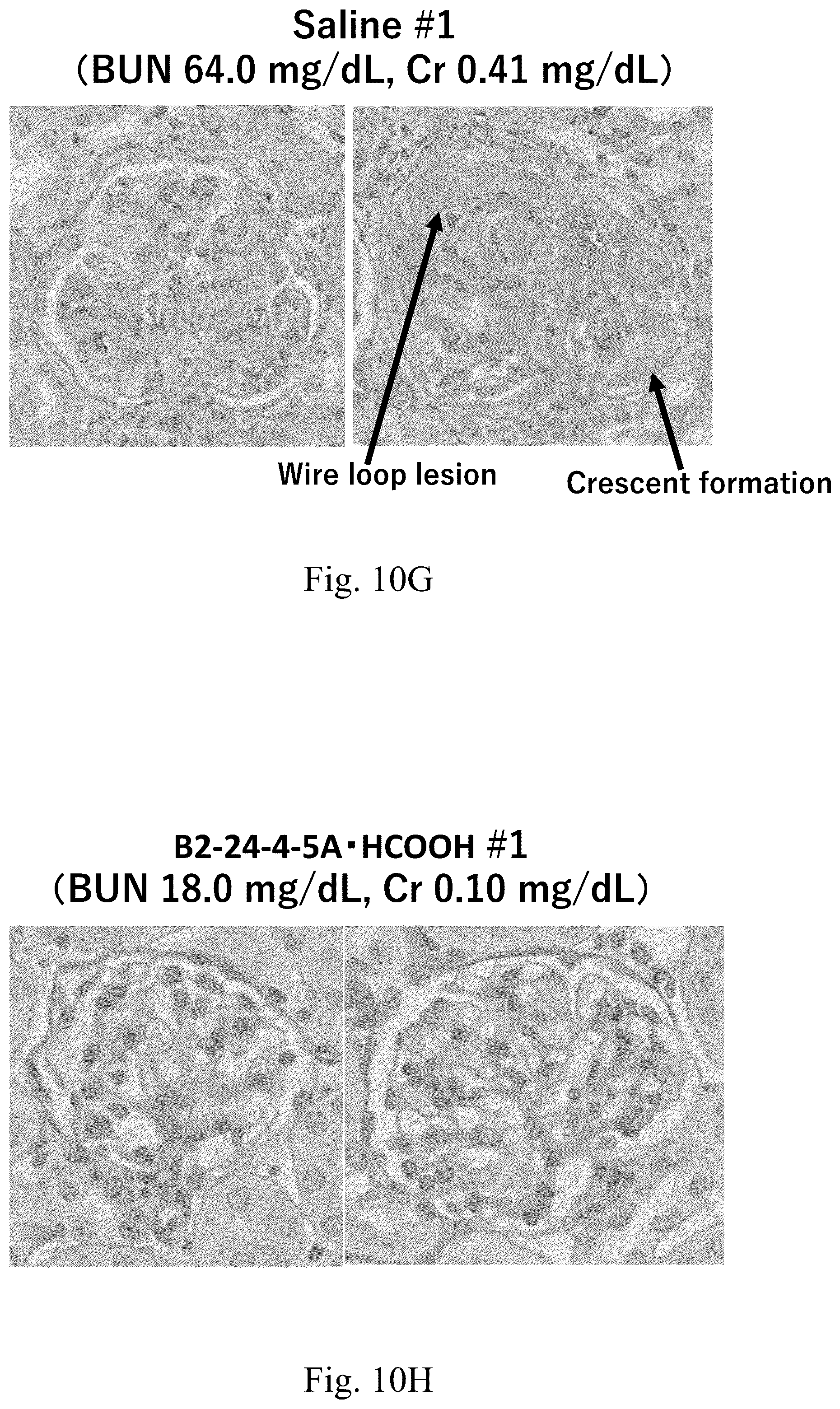 Patent US12410157 Figure 11 – Compound useful as toll-like receptor 7 activation inhibitor