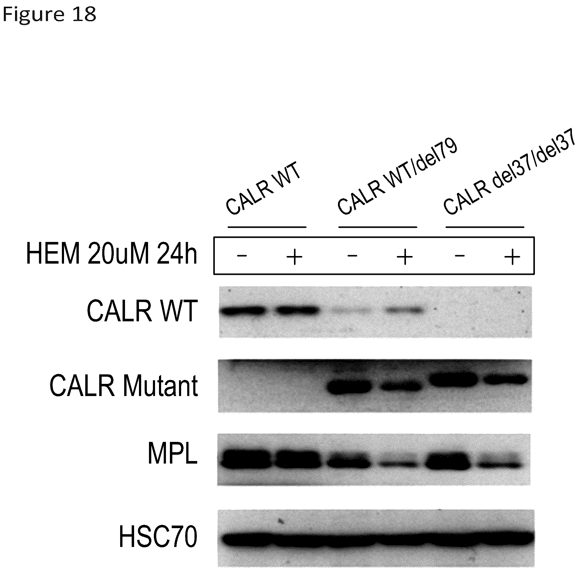 Patent US12410185 Figure 18 – Compounds targeting mutant calreticulin
