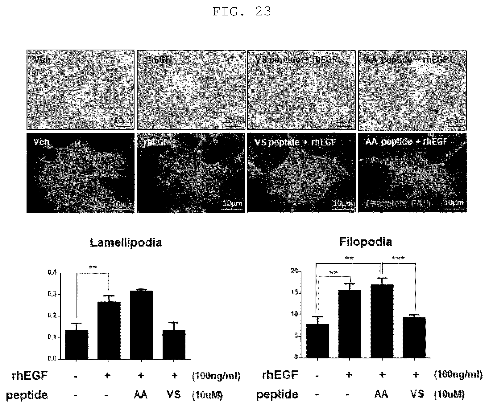 Patent US12410219 Figure 14 – Polypeptide derived from CAP1 and pharmaceutical composition comprising same as effective ingredient