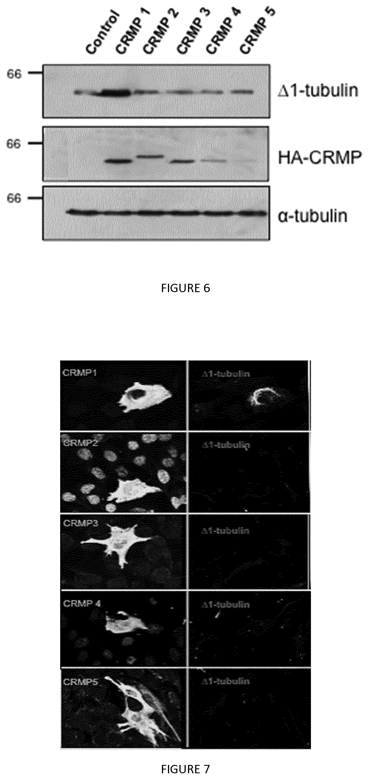 Patent US12410237 Figure 4 – Methods for purifying proteins having a tubulin carboxypeptidase activity and peptidic based inhibitors thereof