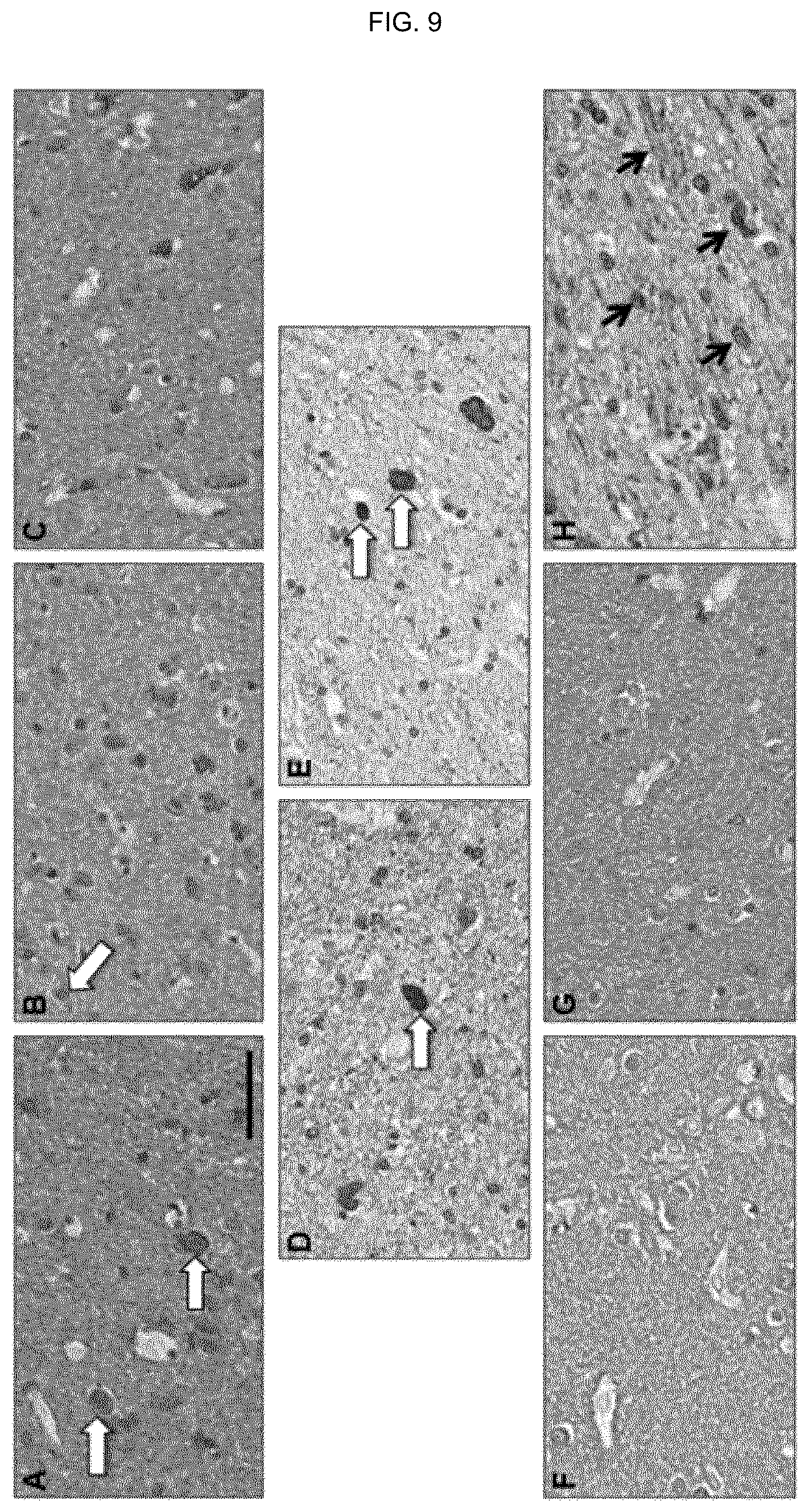 Patent US12410244 Figure 11 – Anti-alpha-synuclein antibodies