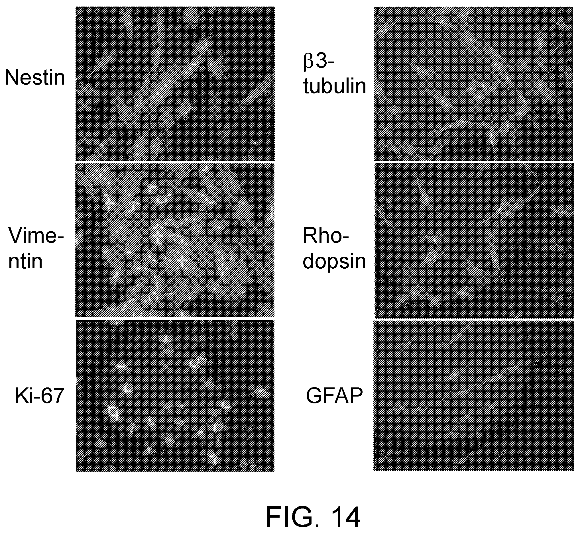 Patent US12410399 Figure 17 – Compositions and methods for treating retinal diseases