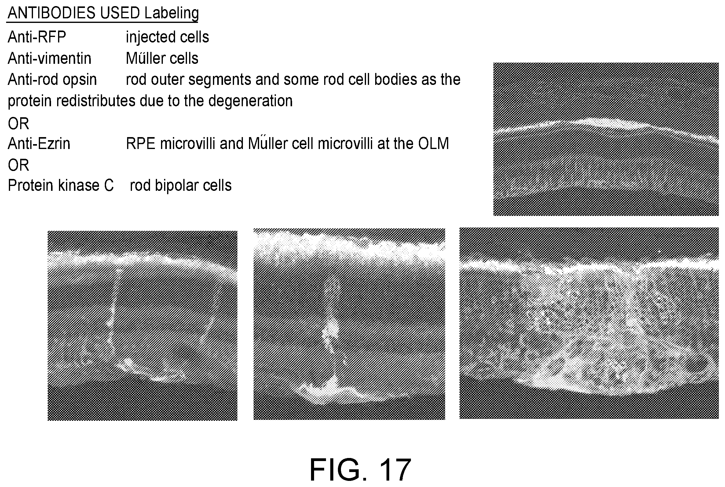 Patent US12410399 Figure 20 – Compositions and methods for treating retinal diseases