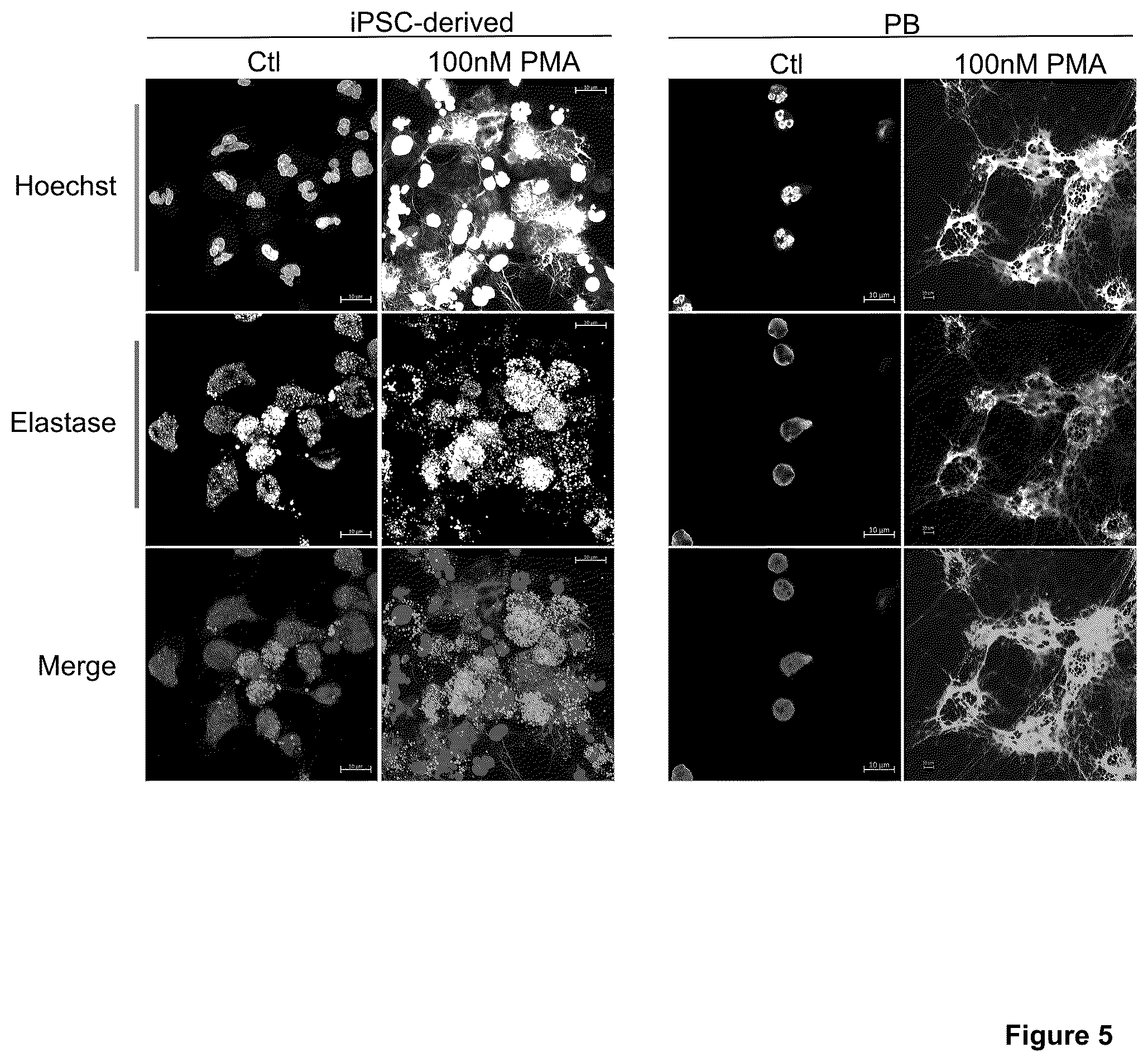 Patent US12410401 Figure 7 – Generation of functional neutrophils and macrophages from induced pluripotent stem cells in chemically defined conditions using transient expression of ETV2
