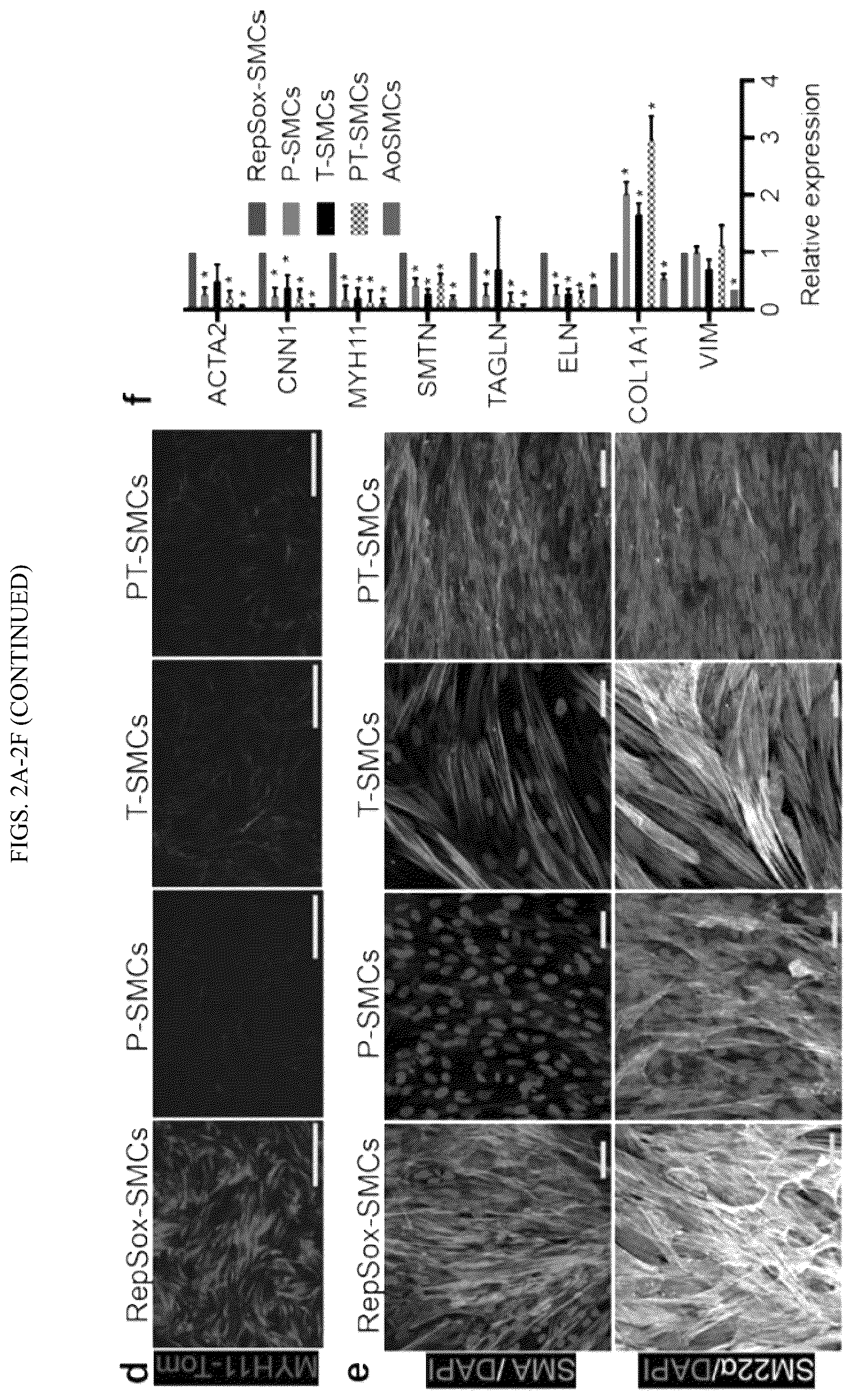 Patent US12410404 Figure 4 – Human pluripotent stem cell-based screening for smooth muscle cell differentiation and disease