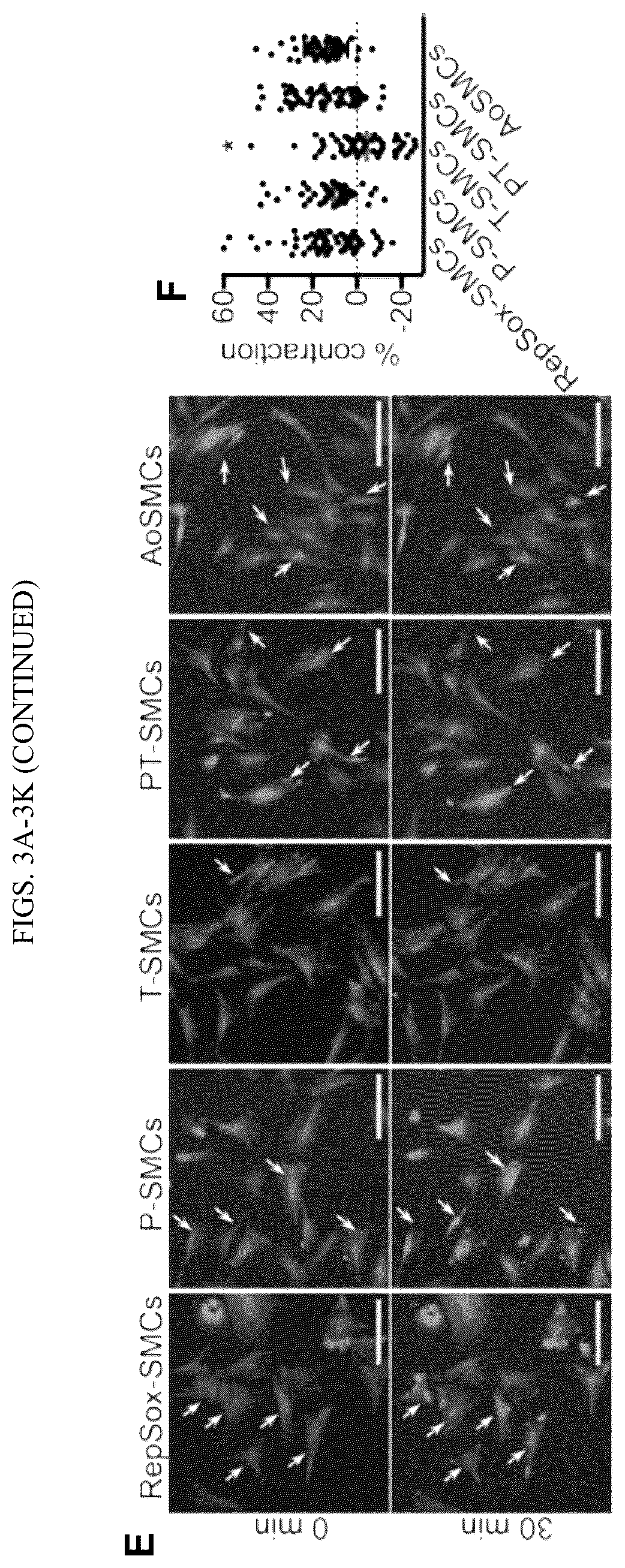 Patent US12410404 Figure 6 – Human pluripotent stem cell-based screening for smooth muscle cell differentiation and disease