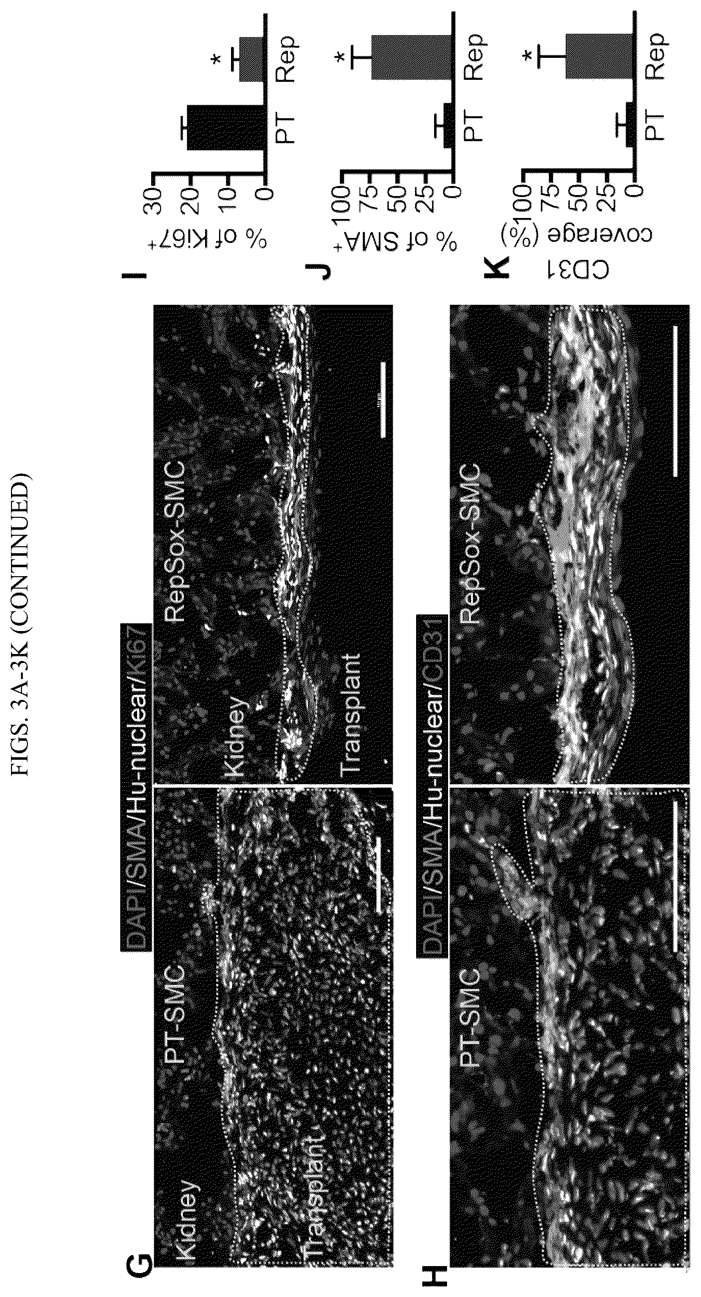 Patent US12410404 Figure 7 – Human pluripotent stem cell-based screening for smooth muscle cell differentiation and disease