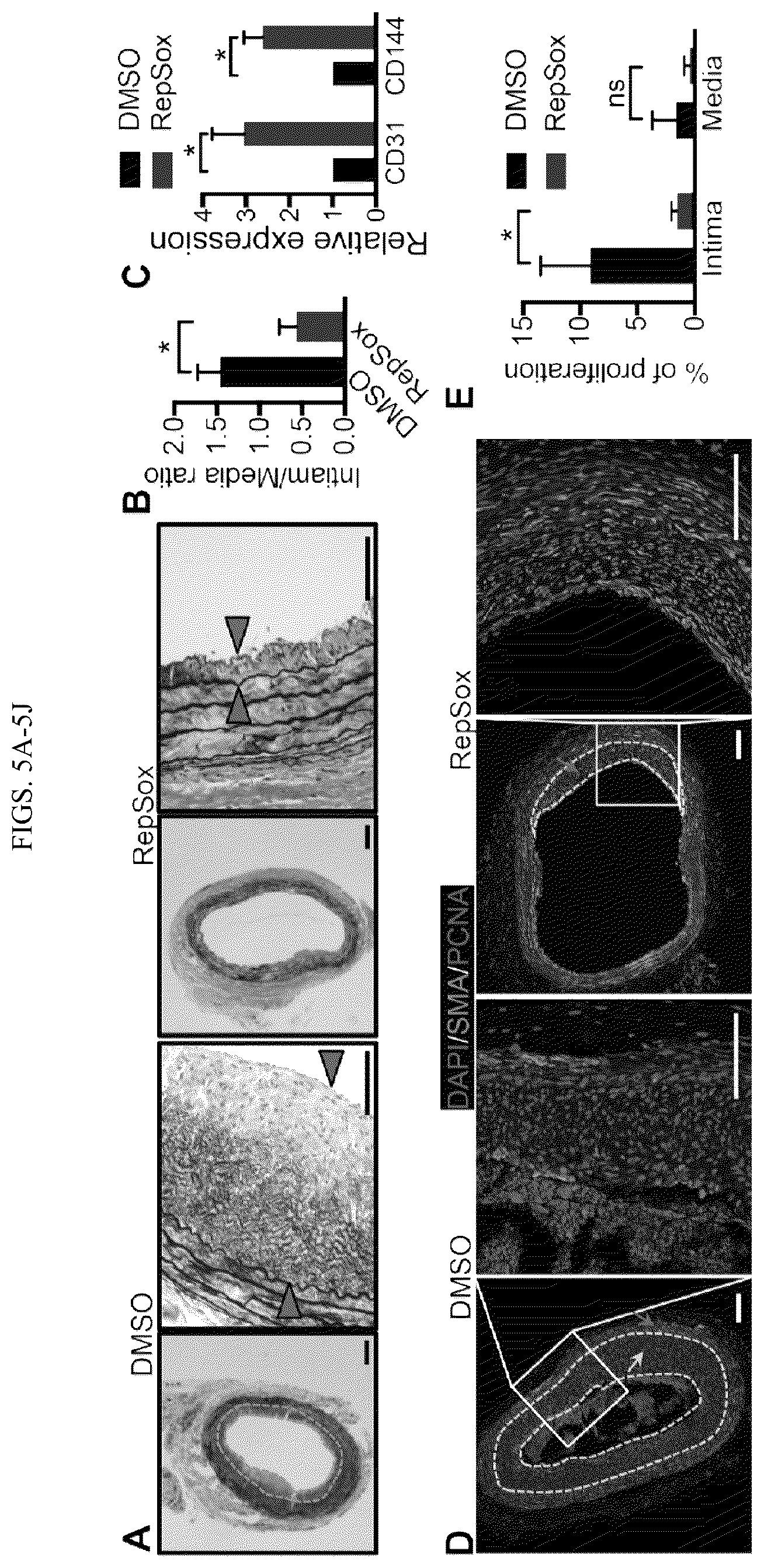 Patent US12410404 Figure 10 – Human pluripotent stem cell-based screening for smooth muscle cell differentiation and disease