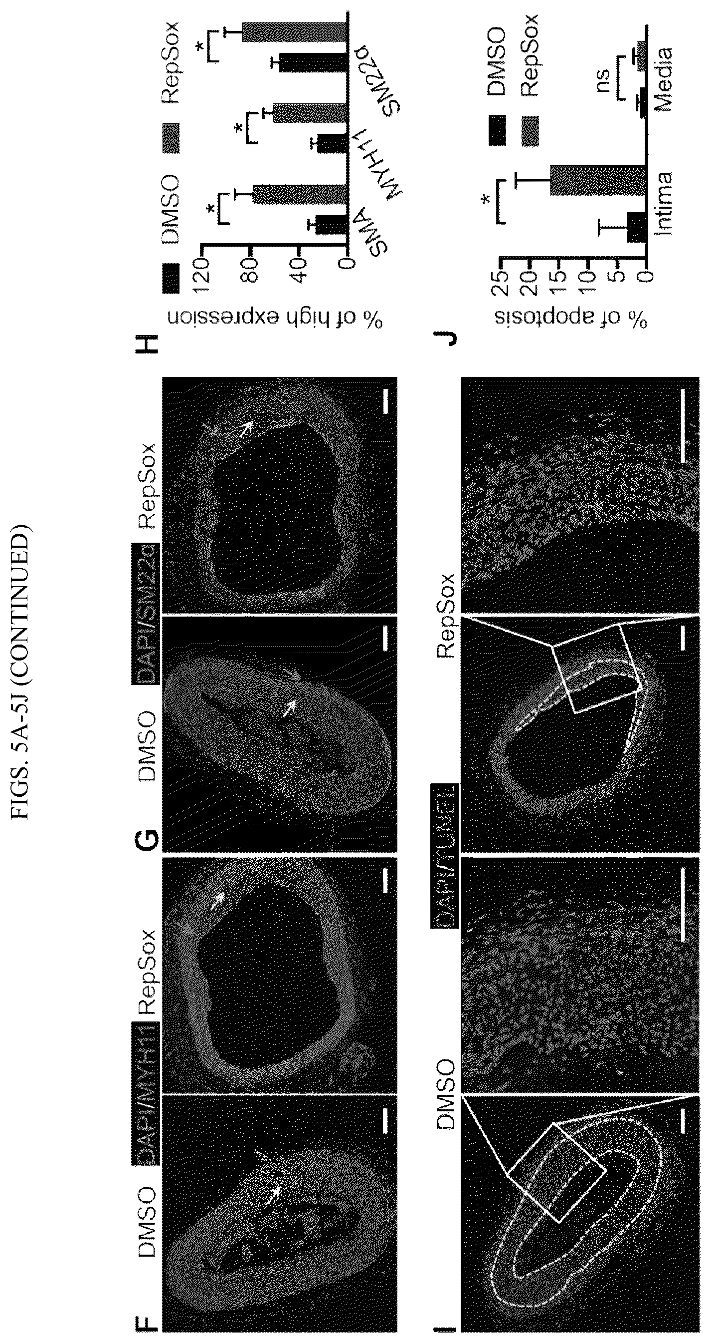 Patent US12410404 Figure 11 – Human pluripotent stem cell-based screening for smooth muscle cell differentiation and disease