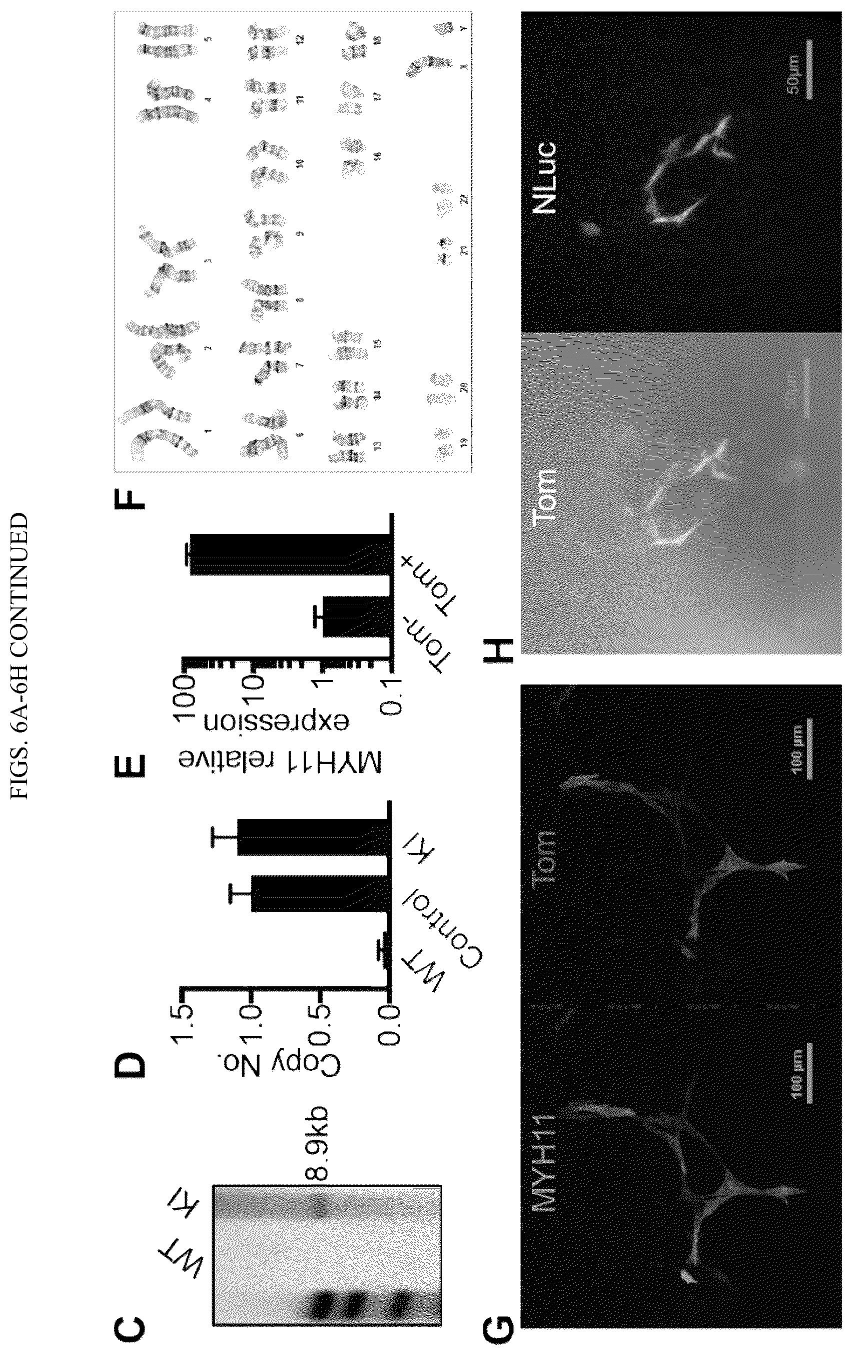Patent US12410404 Figure 13 – Human pluripotent stem cell-based screening for smooth muscle cell differentiation and disease