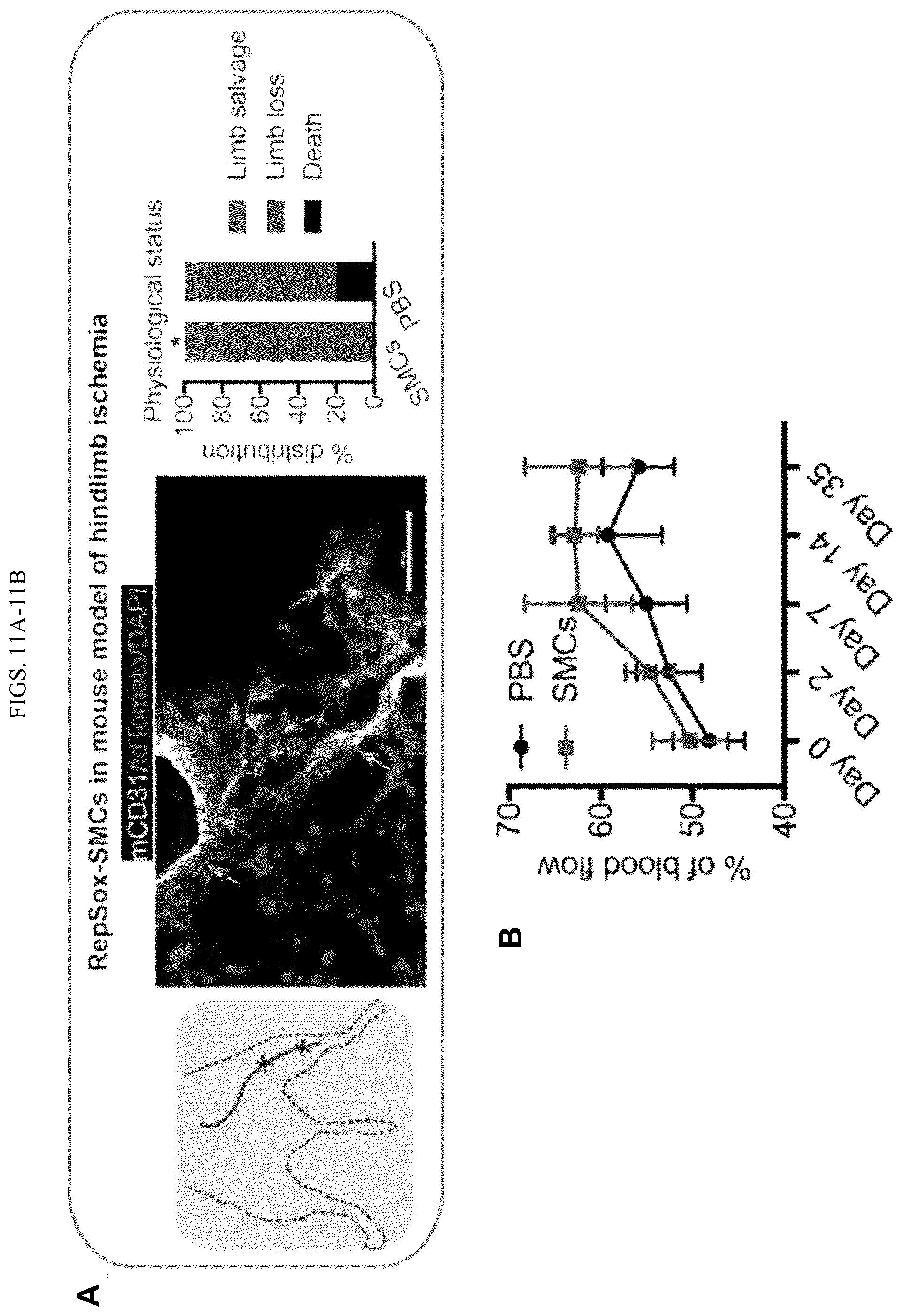 Patent US12410404 Figure 19 – Human pluripotent stem cell-based screening for smooth muscle cell differentiation and disease