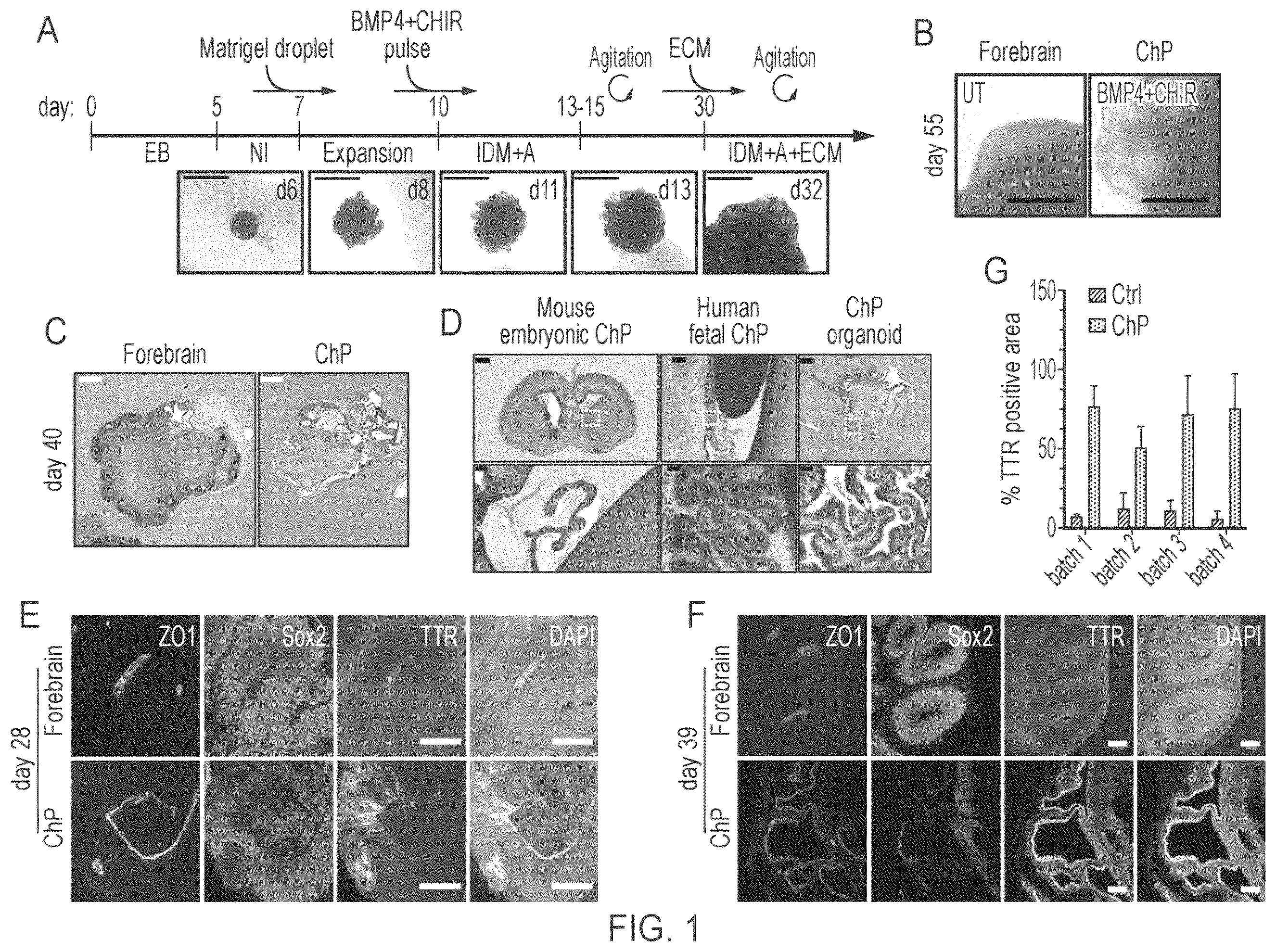 Patent US12410407 Figure 1 – Choroid plexus organoids and methods for production thereof