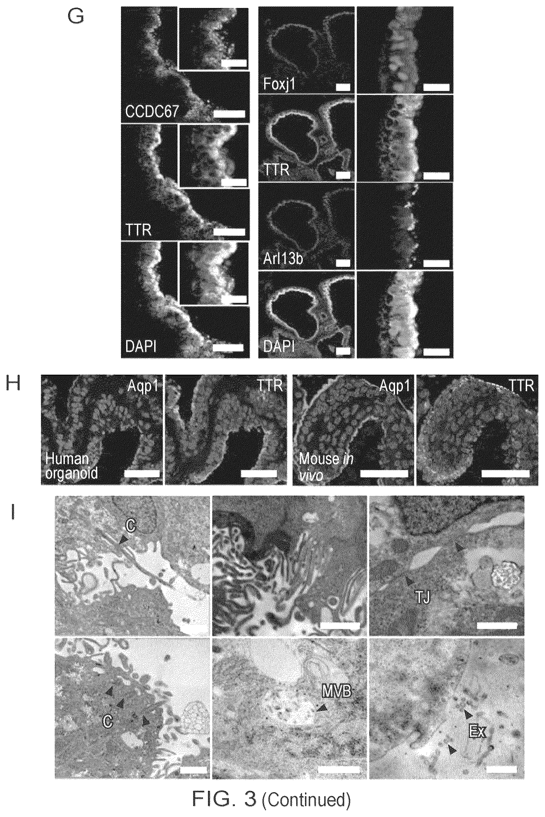 Patent US12410407 Figure 8 – Choroid plexus organoids and methods for production thereof