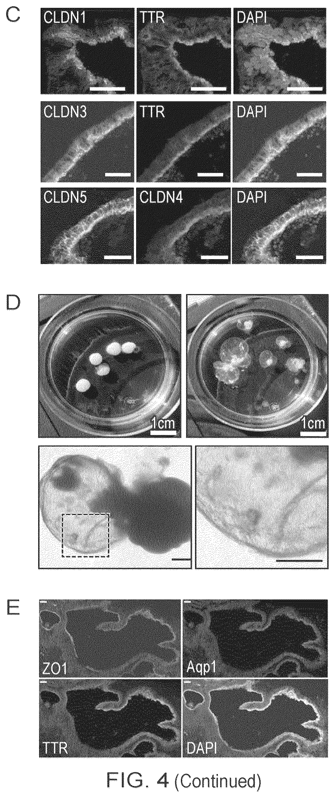 Patent US12410407 Figure 11 – Choroid plexus organoids and methods for production thereof